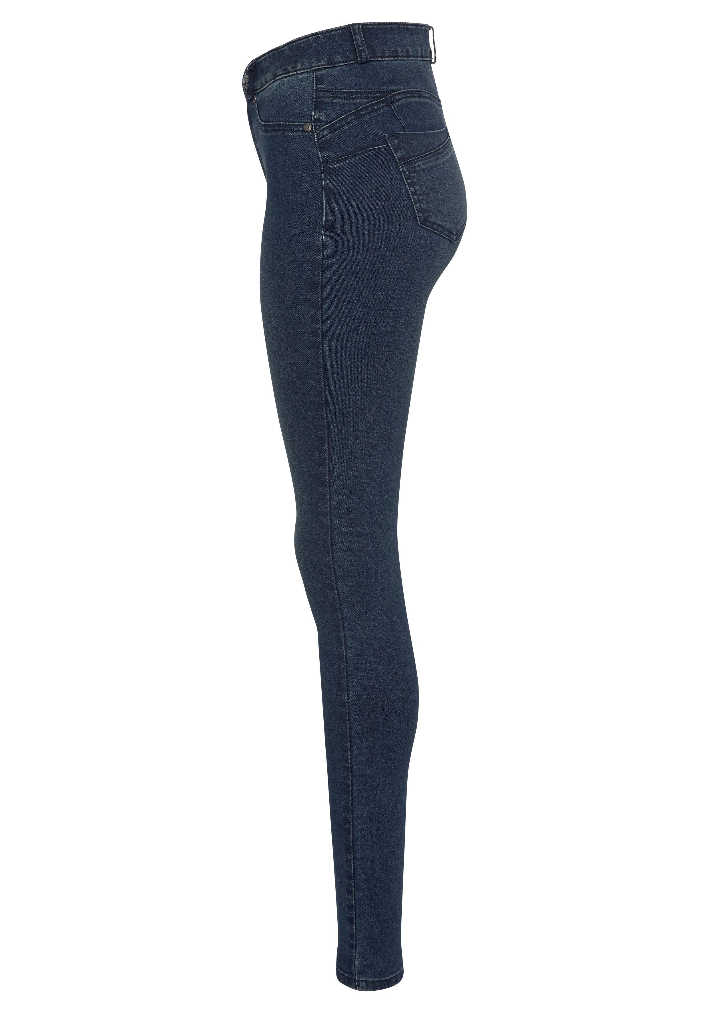 Arizona High dark-blue-used Stretch mit Waist Ultra Shapingnähten Skinny-fit-Jeans