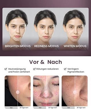 JOVS Kosmetikbehandlungsgerät Gesichtspflege, Anti-Aging, verringern Pigmentflecken & Hautrötung, Drei Models : BRIGHTENREDNESSWHITEN