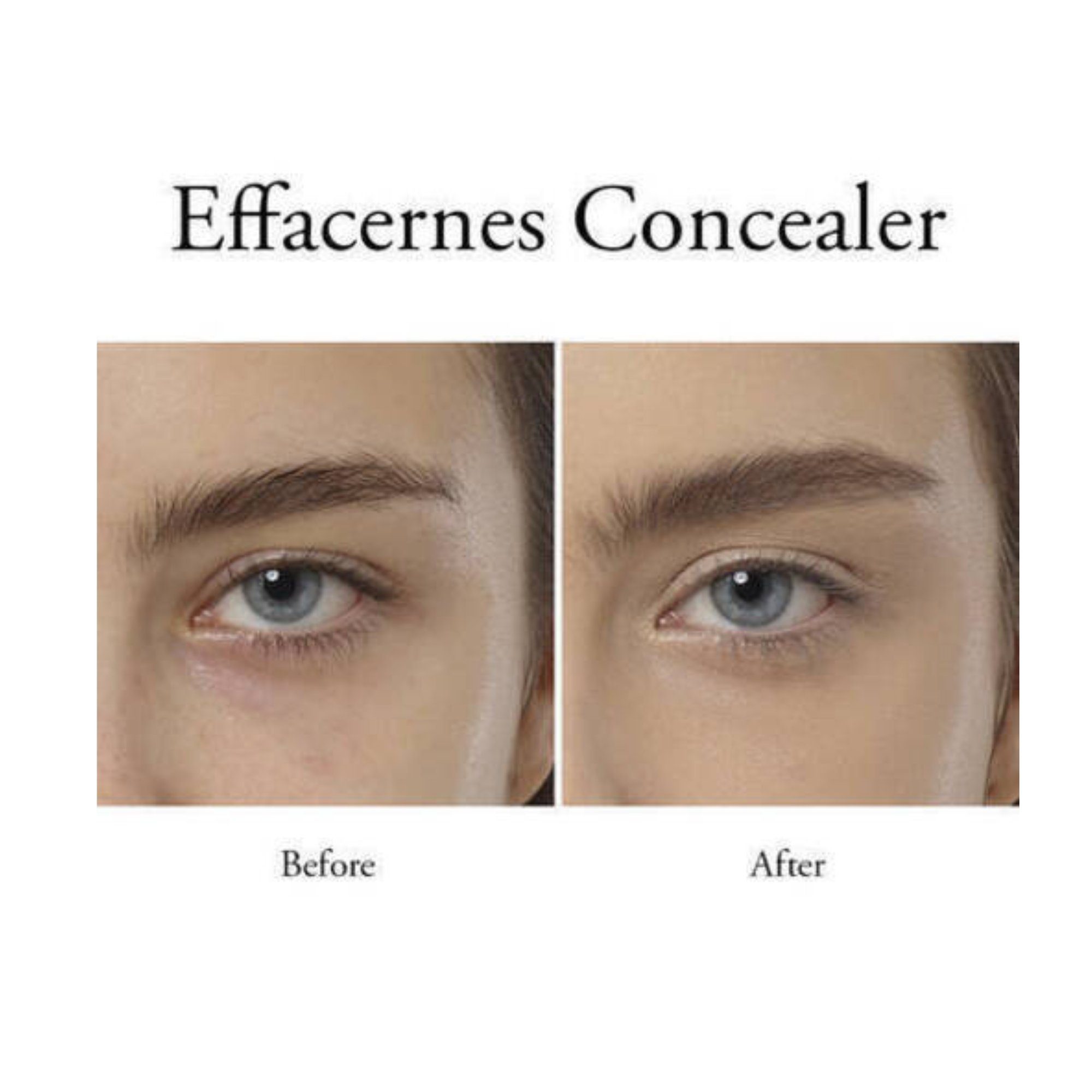 LANCOME Concealer Effacernes Waterproof Long-Lasting Undereye Concealer 310 Camee, 14 gr