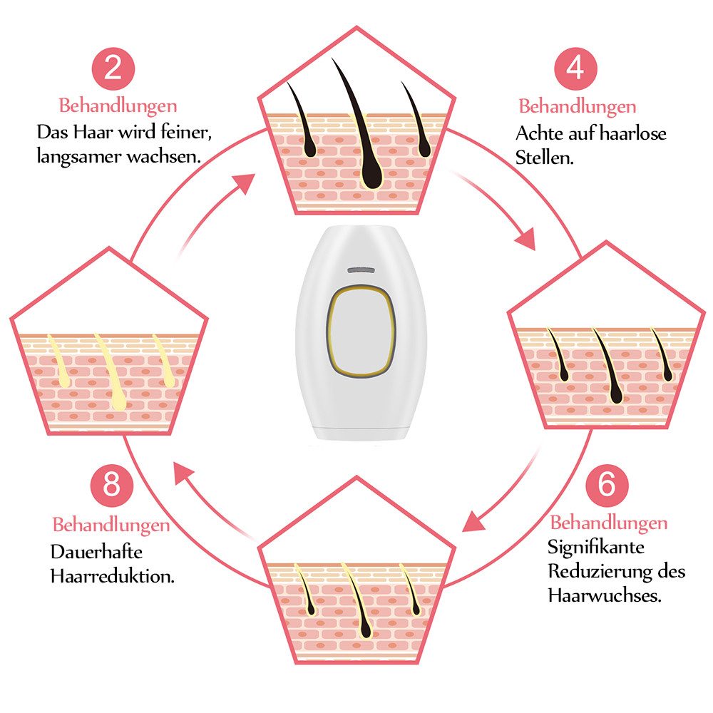 TUWENA IPL-Haarentferner IPL Geräte Haarentfernung Laser, 5 Energiestufen Haarentfernungsgerät, für Frauen Männer Gesicht Achseln Beine und Körper – Bild 3 von 5