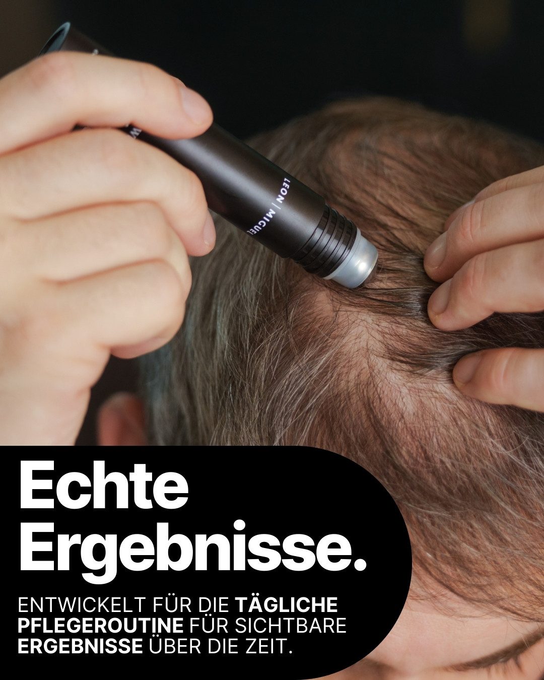 Leon Miguel Haarserum hair growth activator, Fördert Haarwachstum, reduziert Haarausfall