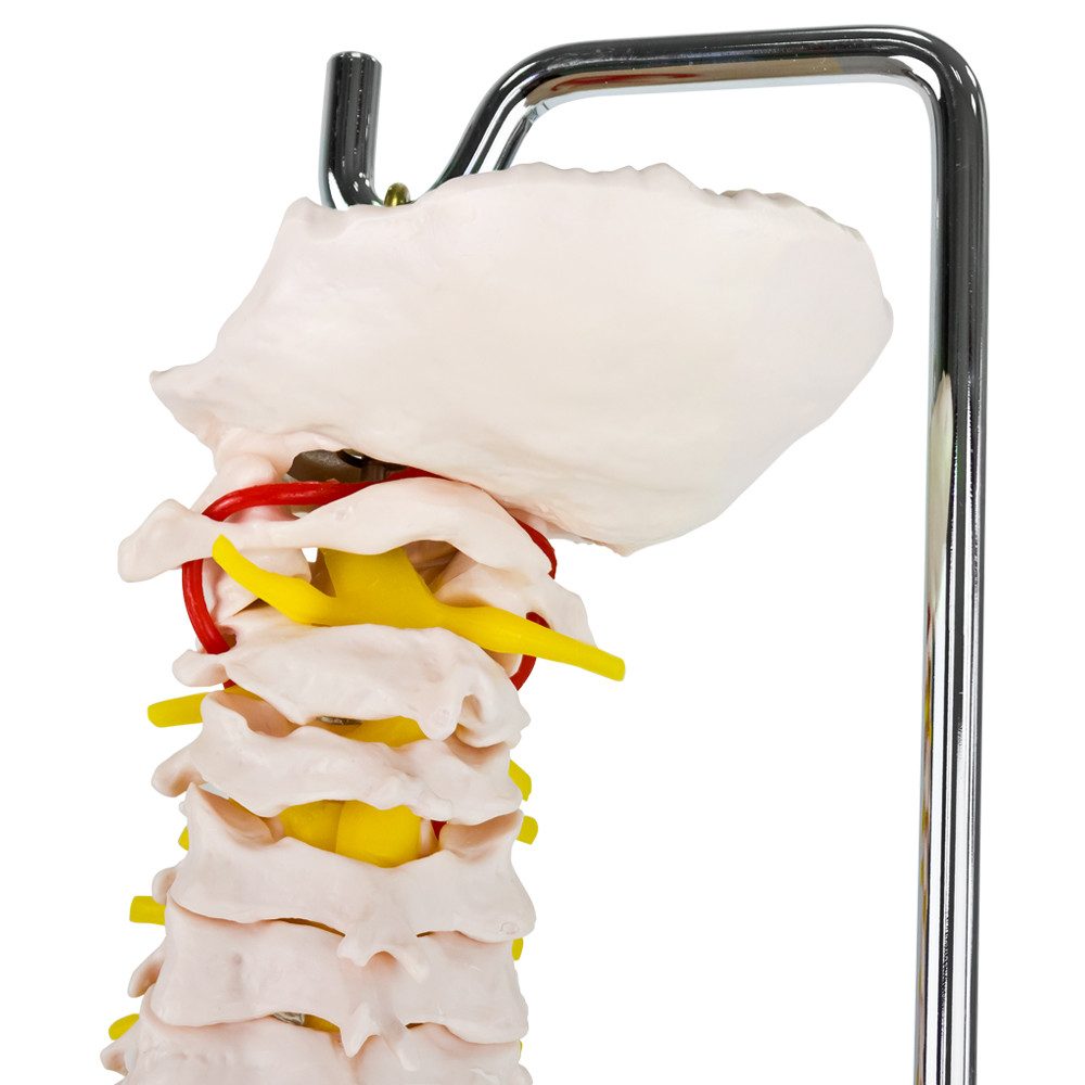 MedMod Dekoobjekt Anatomie Modell Skelett Wirbelsäule ​Lebensgroß Bandscheibenvorfall