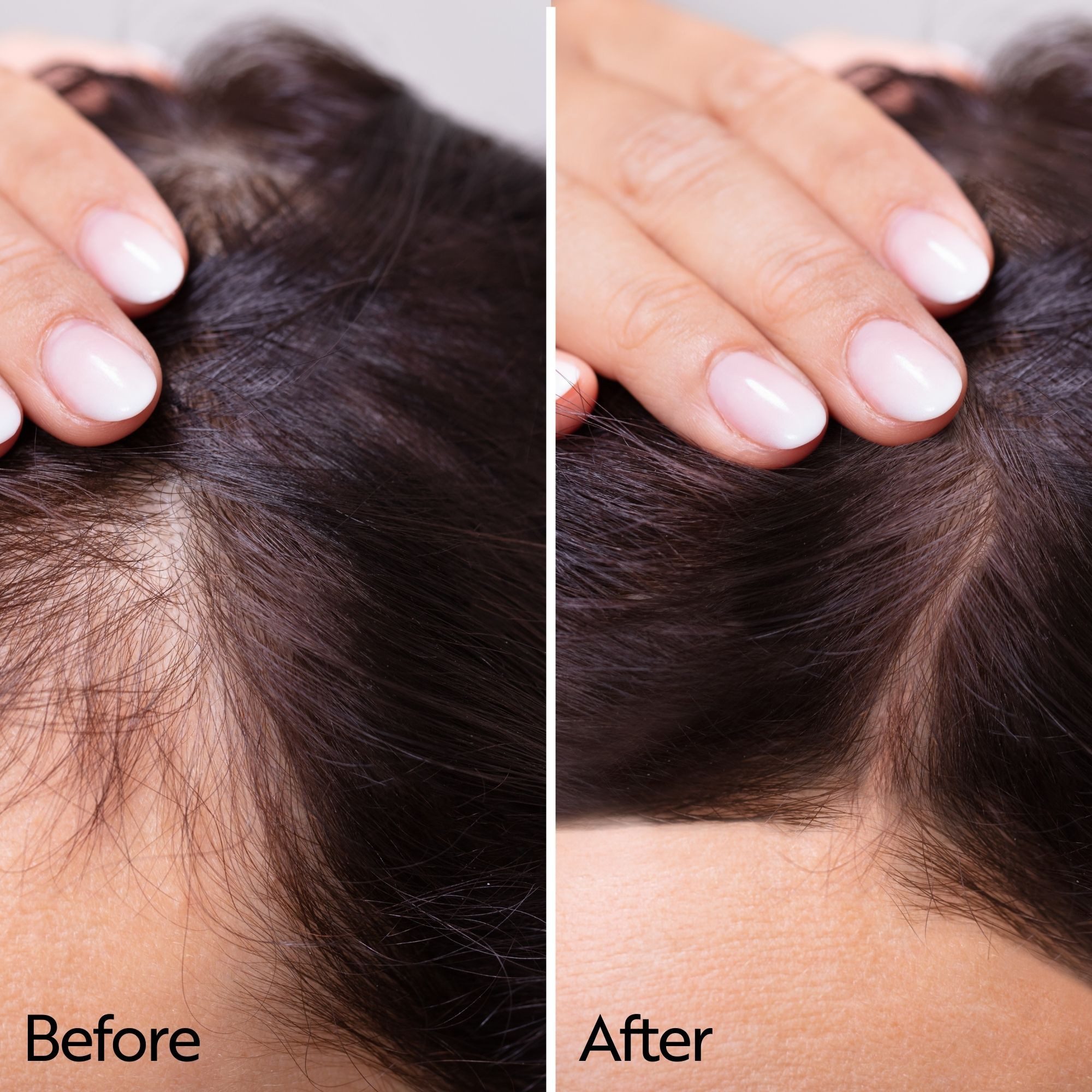 Ahuhu Kopfhaut-Pflegeserum ahuhu - hair elixir