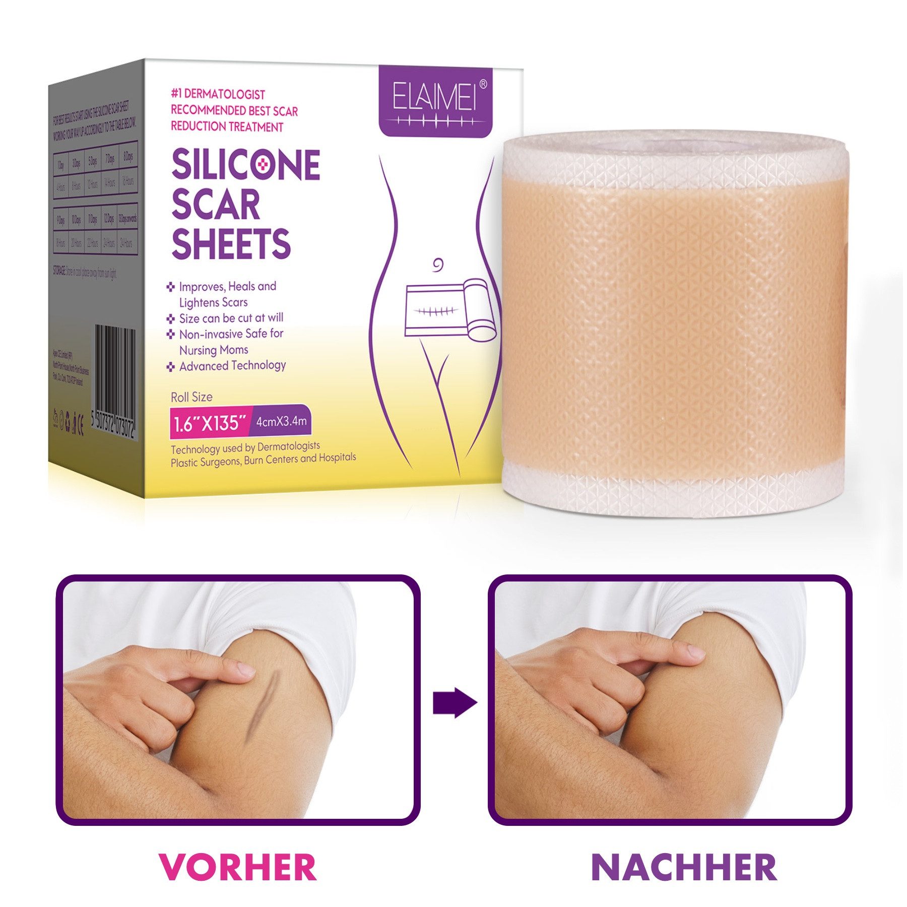 P-Beauty Cosmetic Accessories Wundpflaster Narbenpflaster Narben Reduktion Silicone Scar Sheets in 5 Größen