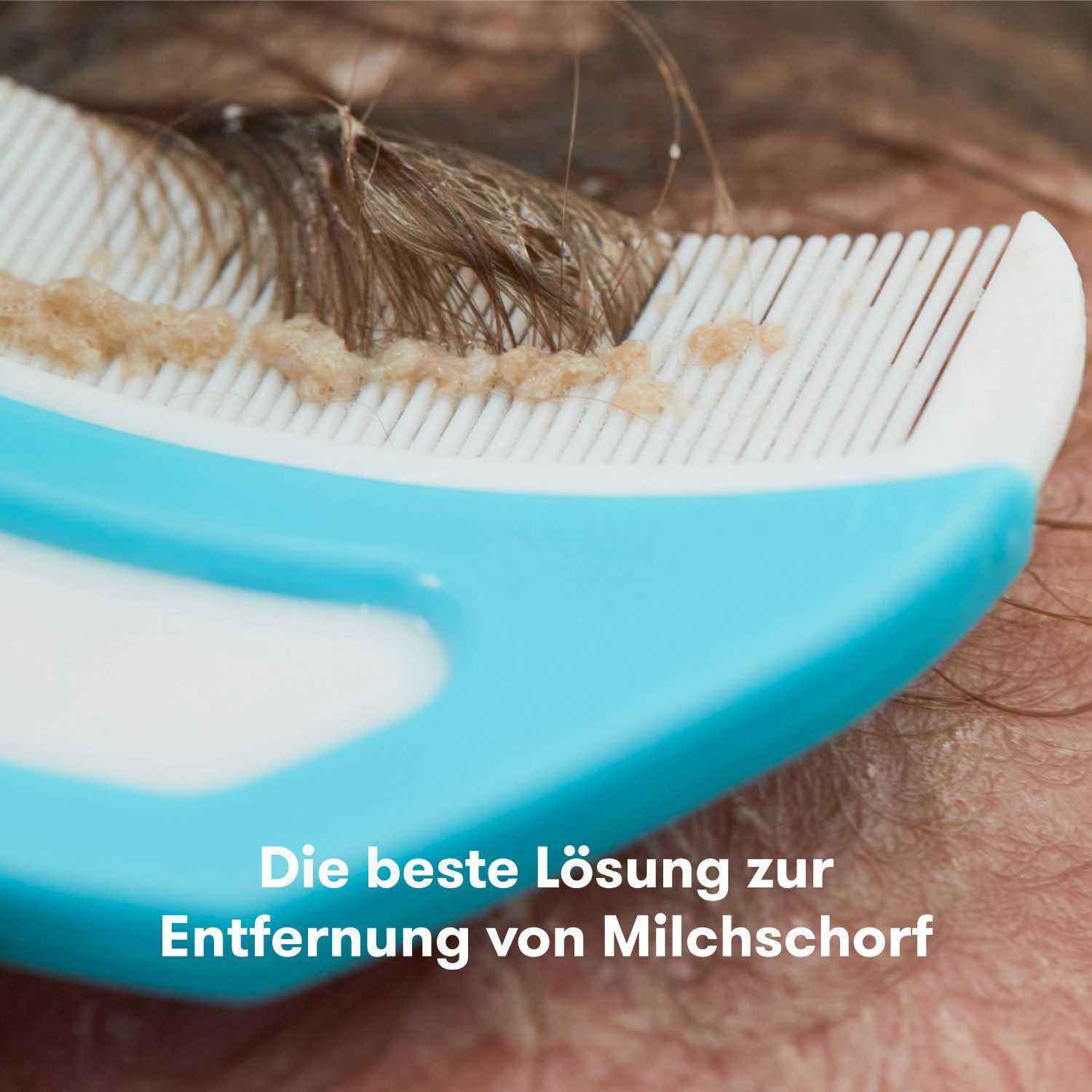 Frida Badebürste Flake Fixer 3-in-1 Milchschorf-Set für Babys und Kleinkinder, weicher Schaumstoffschwamm mit einer sanften Bürste