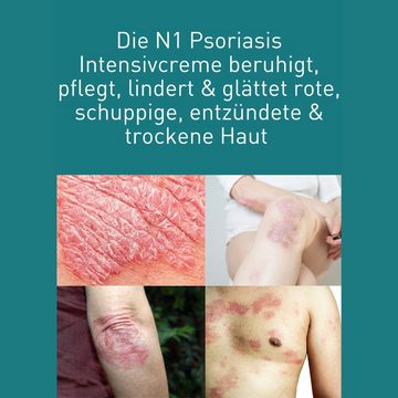 N1 Healthcare Körpercreme Psoriasis Intensivcreme, Medizinprodukt, patentierte Rezeptur