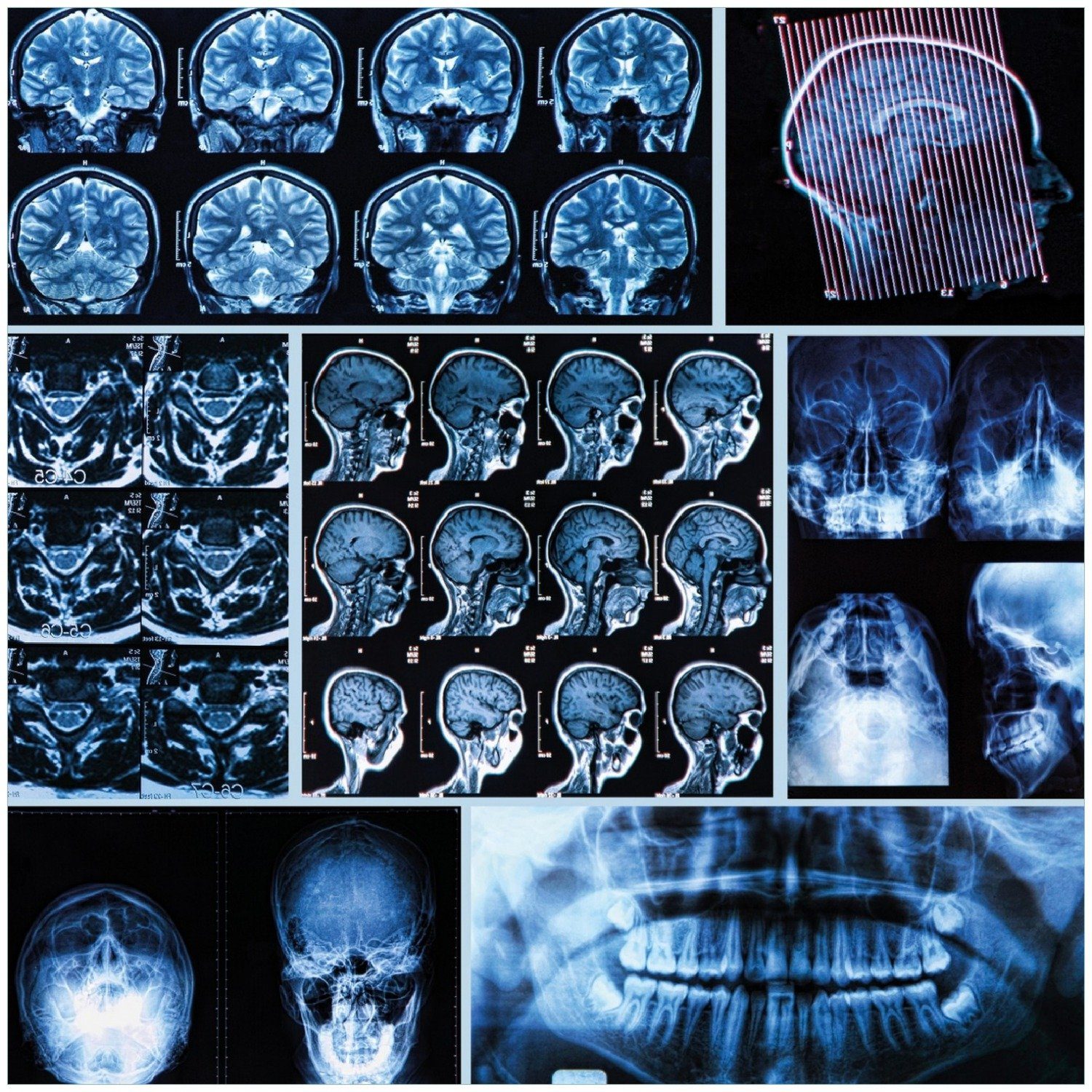 Kopfes Röntgen-Bilder Seiten Wallario menschlichen von Memoboard eines allen
