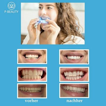 P-Beauty Cosmetic Accessories Zahnbleaching-Kit Zahnaufhellung Set Bleichsystem weiße Zähne Teeth Whitening