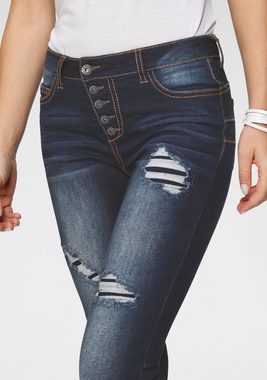 Arizona Slim-fit-Jeans mit sichtbarer, schräger Knopfleiste Mid Waist