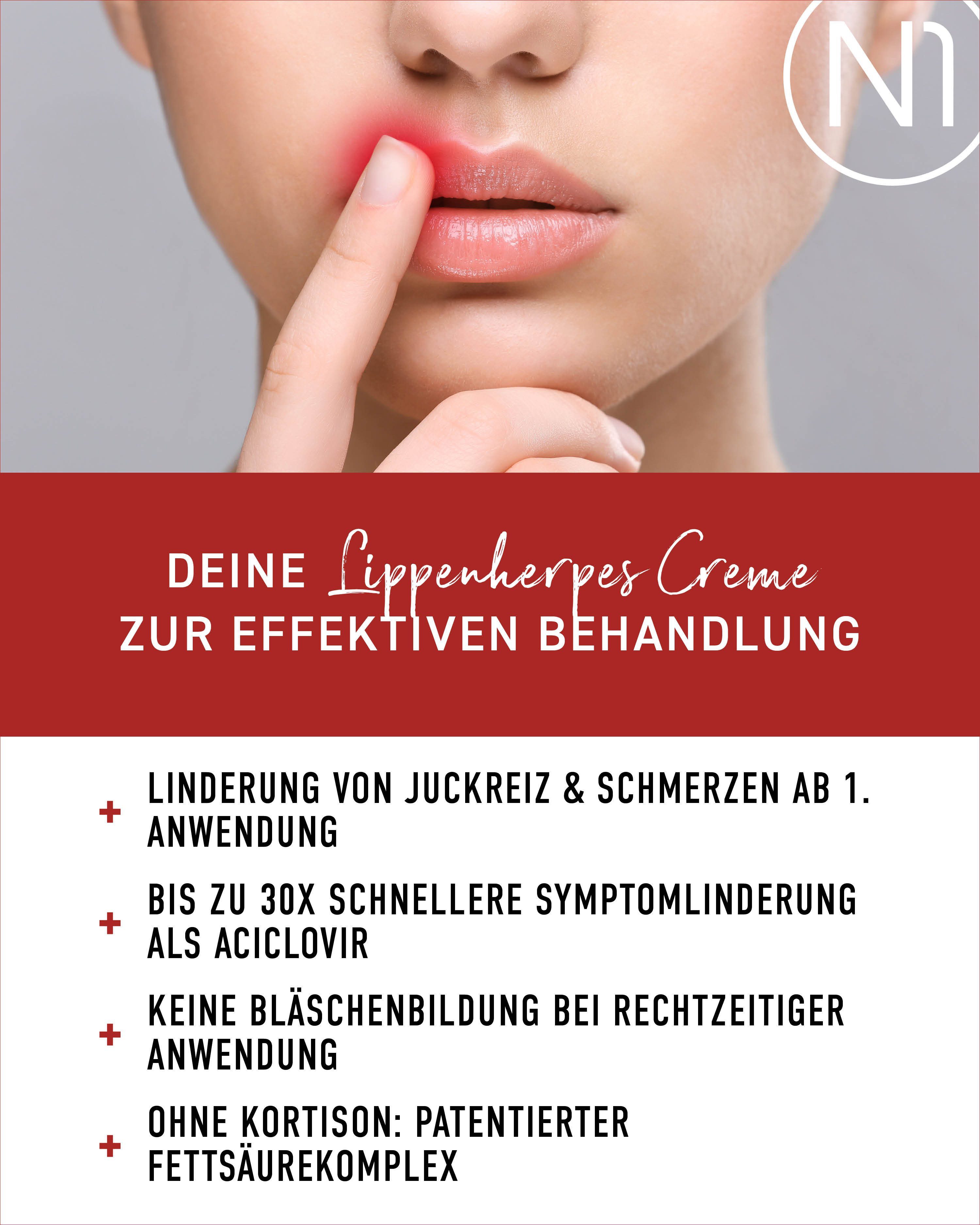 N1 Healthcare Lippencreme N1 Lippenherpes Creme, 4g, wirkt sofort, patentiert, geöffnet 6 Monate haltbar