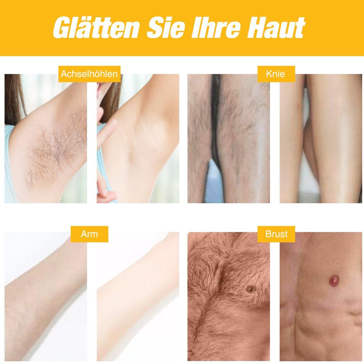 5 für 999,000 LETGOSPT 999,999 Körper, Haarentfernung Geräte IPL Lichtimpulse, Epilierer Mit Blitze Energiestufen, Gesicht, Laser, Achseln, IPL-Haarentferner + Bikinizone