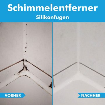 ABACUS Schimmelentferner - Das Profi Set Schimmelentferner (inkl. Experten Tipps, [3, 3-St. Schimmelentferner Profi Set Sofortwirkung mit Langzeiteffekt)