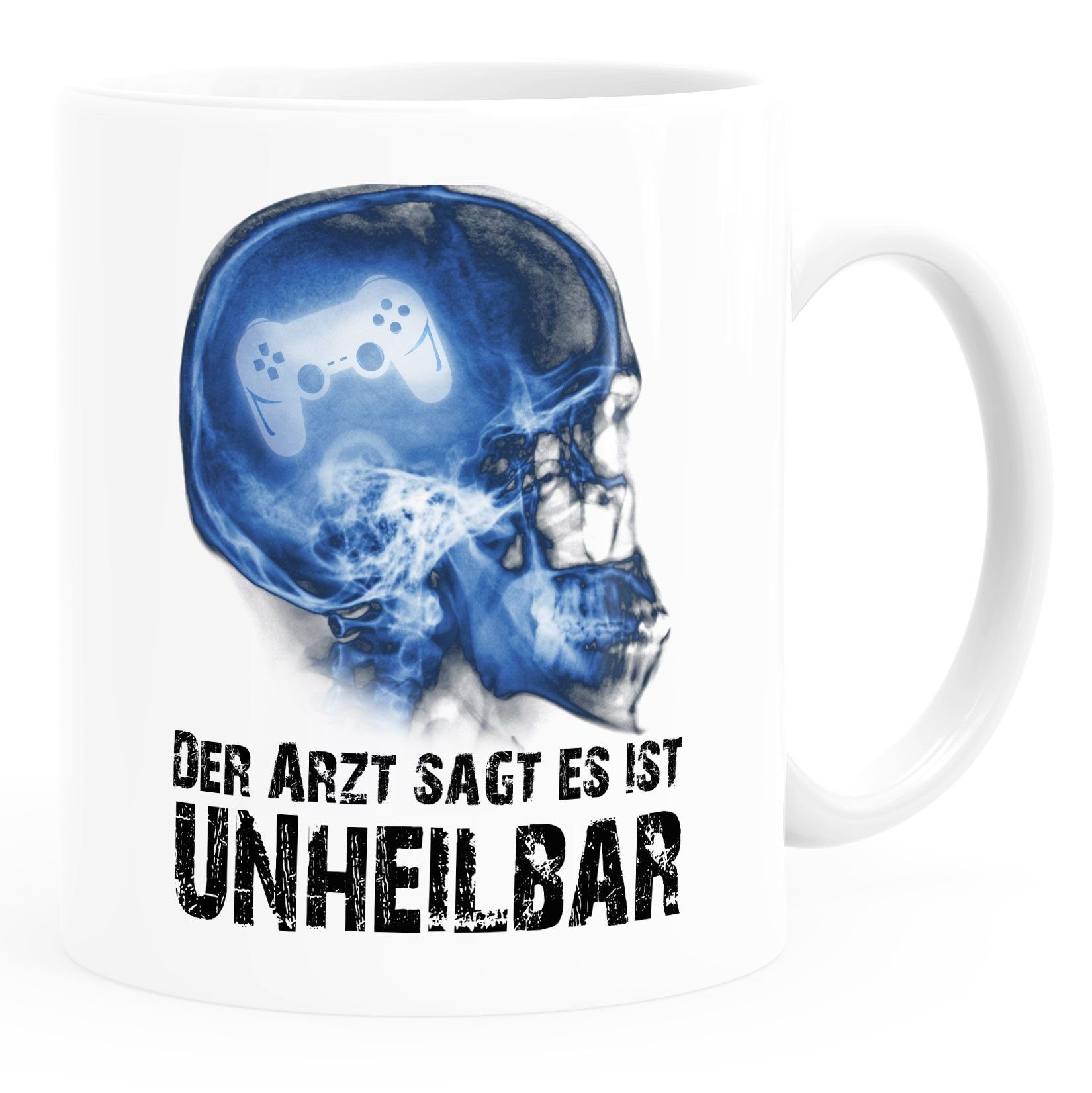 MoonWorks Tasse Kaffee-Tasse Der Arzt sagt es ist unheilbar Hobby Schädel Röntgenbild Schädel Controler Joypad Playstation Zocken Gamer Moonworks®, Keramik