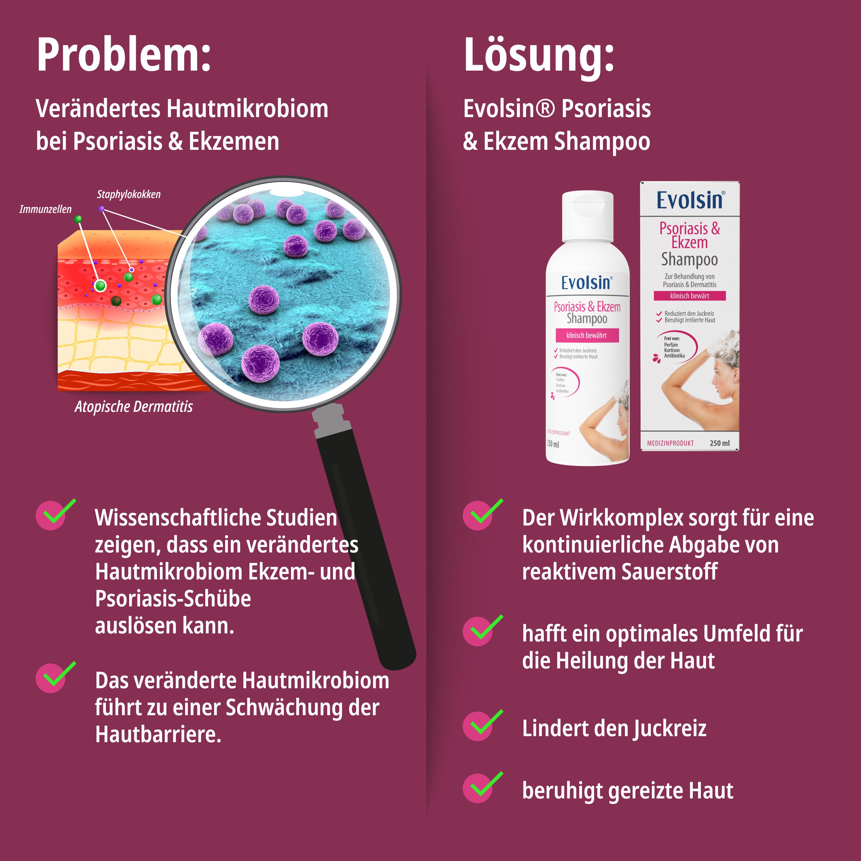 Evolsin Kopfhaut-Pflegeshampoo Ekzem & Psoriasis Shampoo - OHNE Kortison, Patentierte Wirkweise gegen Schuppenflechte und Seborrhoisches Ekzem