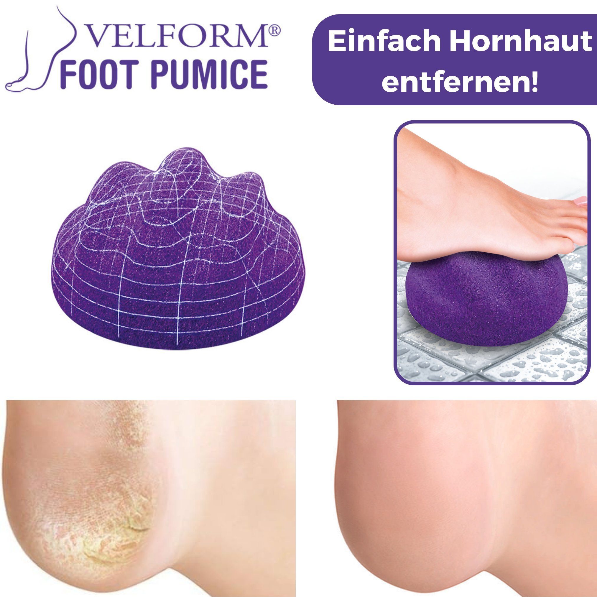 Velform®️ Velform® Bimsstein Foot & Dusche Fußreiniger 1-tlg., für Badewanne Pumice, & Hornhautentferner