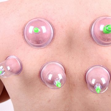 Retoo Gesichtsmassagegerät Schröpfen Set Mit 12tlg Schröpfgläser Cupping Schröpfset Vakuum Massag, Set, 12 Stück Plastikblasenköpfe in verschiedenen Größen, Pumpe, Klein und Größ Schröpfköpfe, Es hat eine gesundheitsfördernde Wirkung