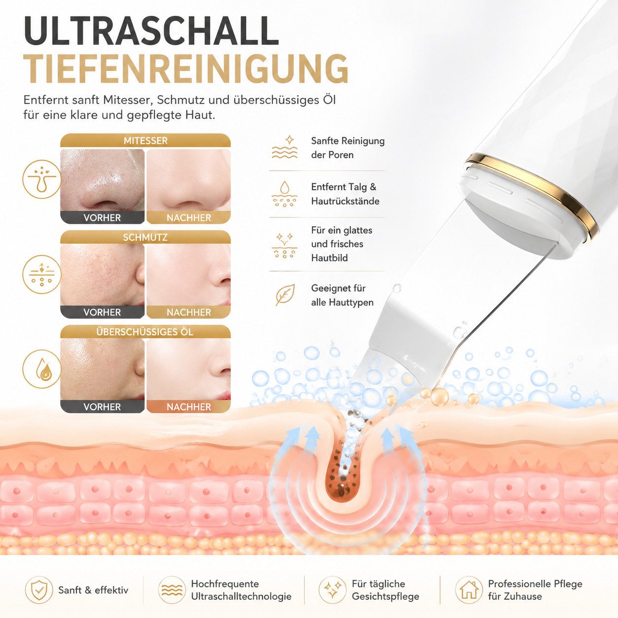 Toomoke Dermaroller Ultraschallpeelinggerät, Gesichtsspatel Tiefenreinigung 4 modi, Ultraschall-Peeling Porenreiniger Akne-Entferner Ionen Hautreiniger, Pickel und Akne Entferner set, Mikrodermabrasionsgerät