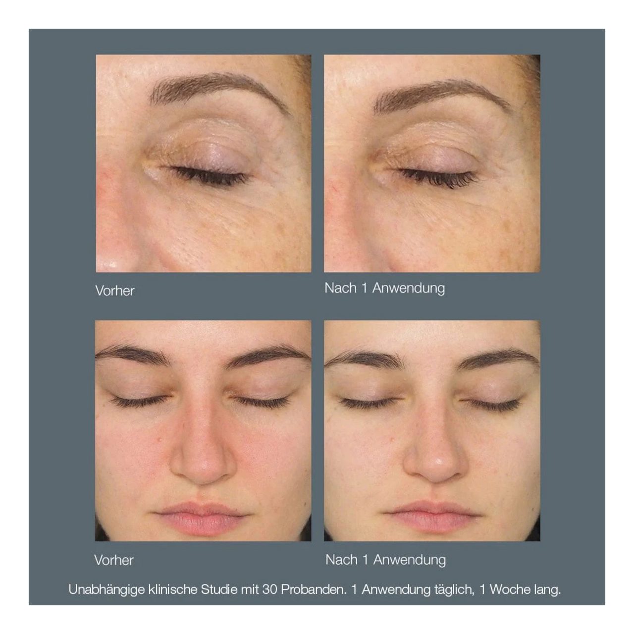 Dermalogica Gesichtspeeling Daily Milkfoliant, Entfernt Make-up, Schmutz und Öl mit sanften Mizel