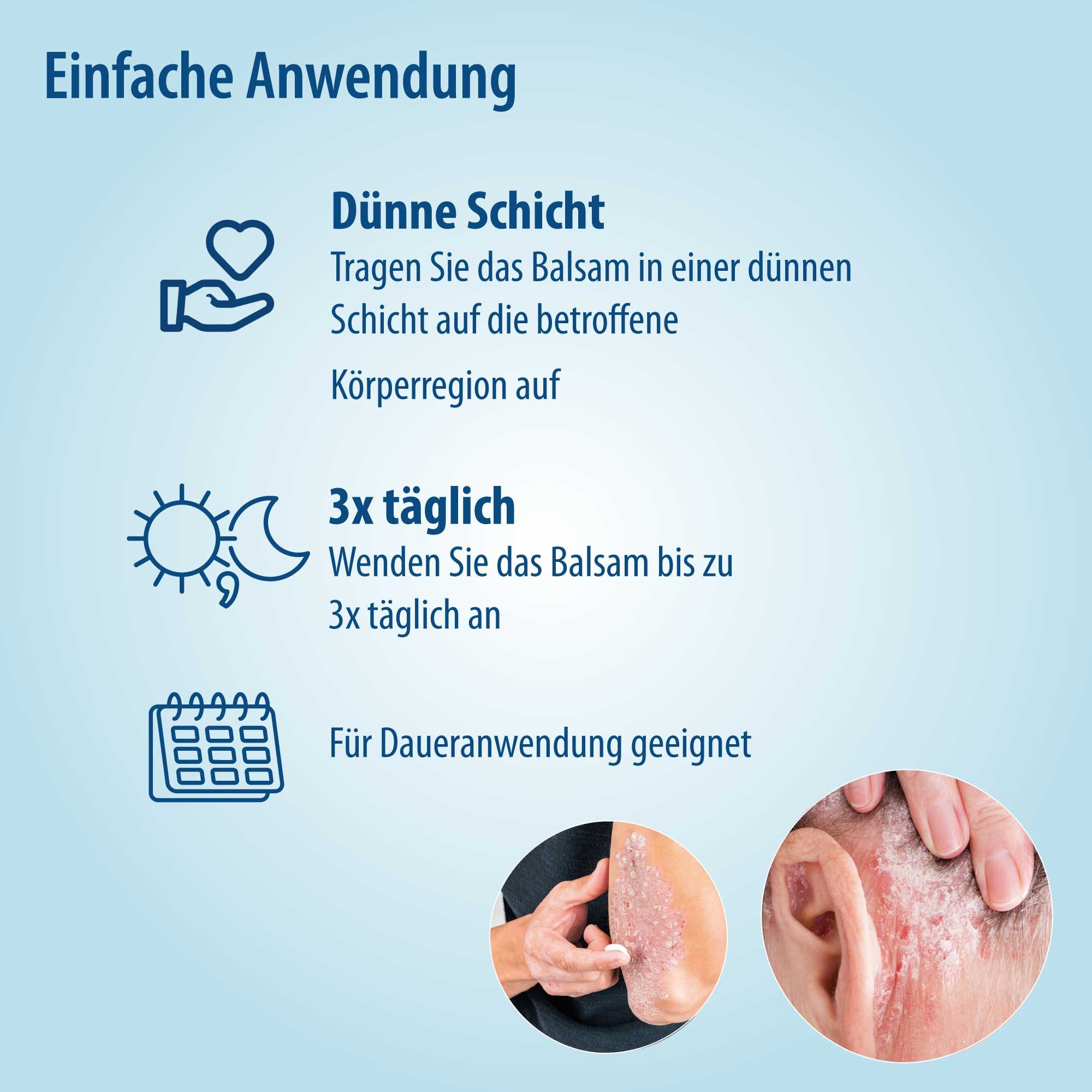 Evolsin Hautcreme Psoriasis Schuppenflechte Balsam - OHNE Kortison, Zertifiziertes Medizinprodukt mit patentierter Wirkweise