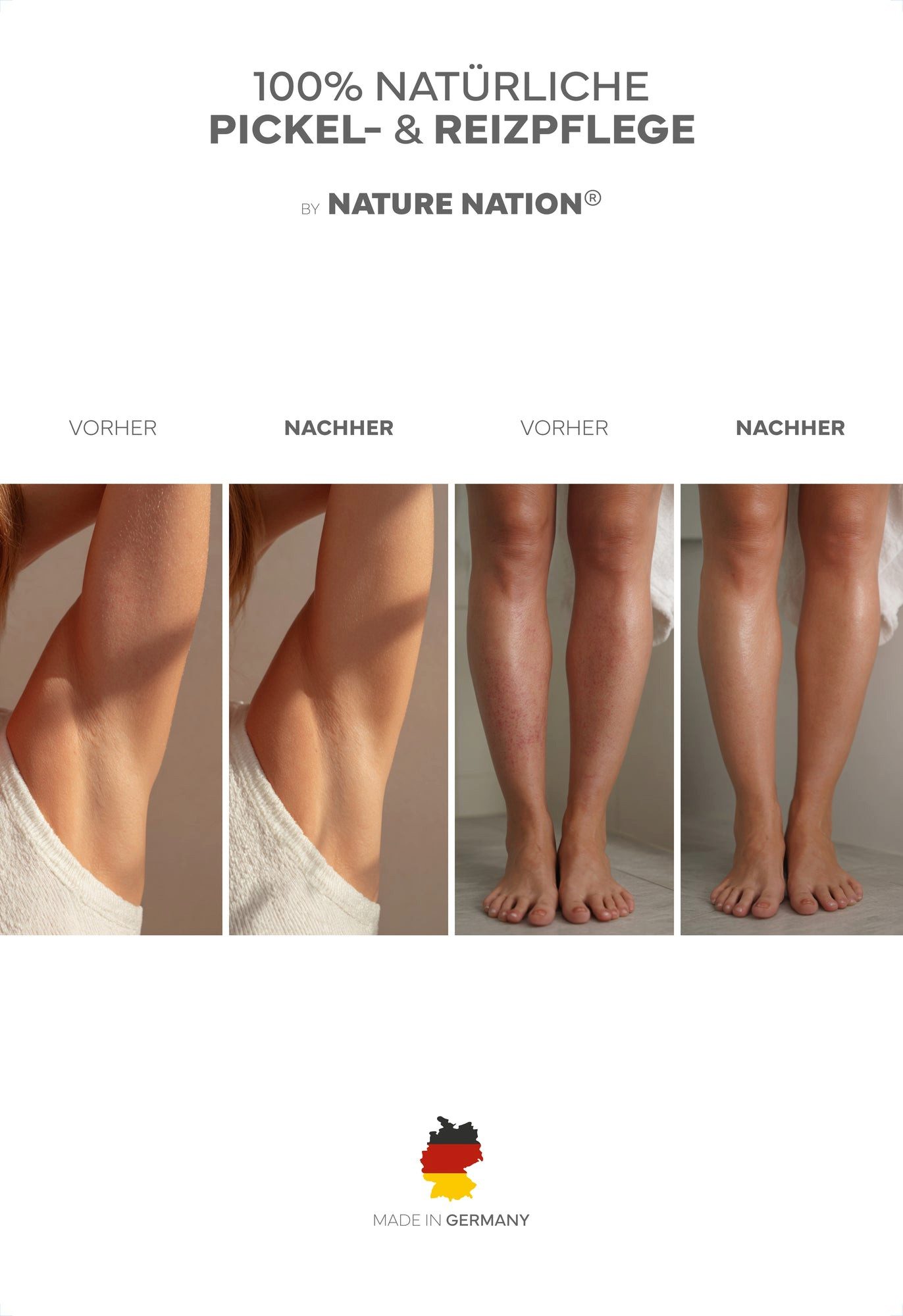 NATURE NATION Körperpflegemittel Intimöl 50ml – After Shave Öl gegen Rasierpickel