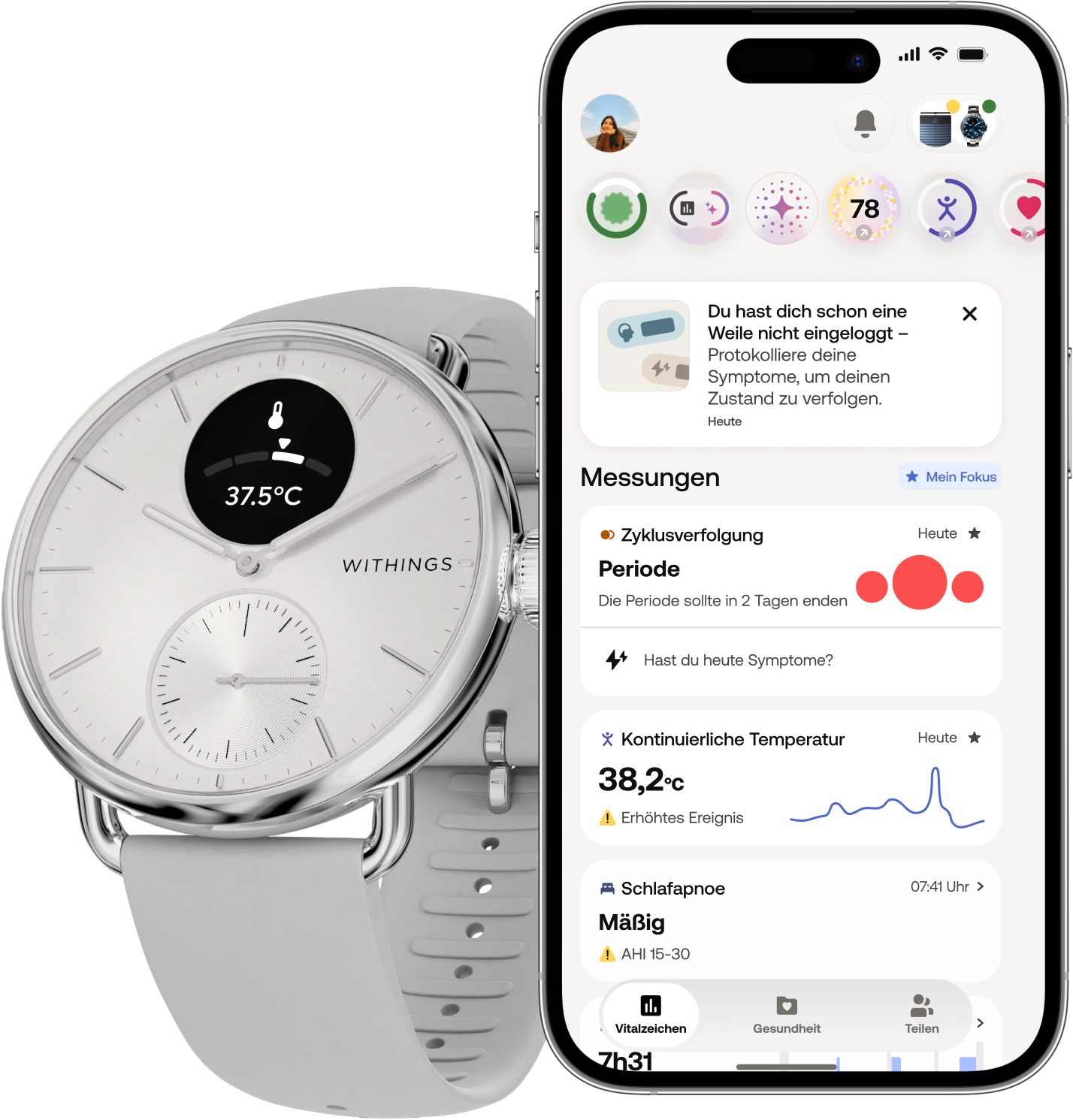 Withings ScanWatch 2 38mm, hybrid, Akku bis 35 Tage, 50 M Wasserdicht Smartwatch (HealthSense OS), Aktivitätstracking, Schlafüberwachung, Herzgesundheit, Temperatur uvm.