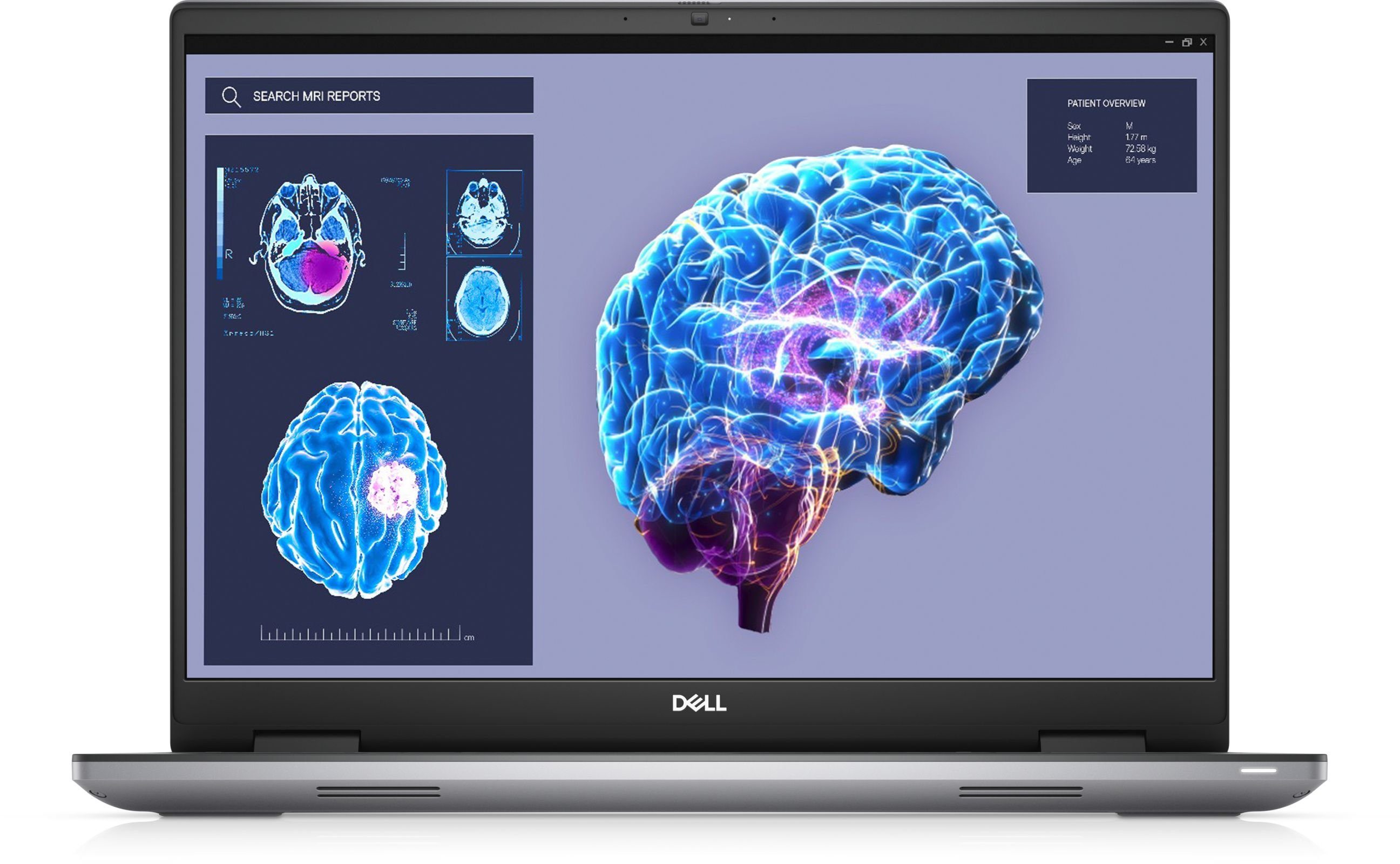PRECISION 7680 I9-13950HX 32GB Notebook