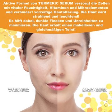 P-Beauty Cosmetic Accessories Gesichtsserum Kurkuma Serum Hyperpigmentation Pigmentflecken Entferner Bio Vegan, 1-tlg.
