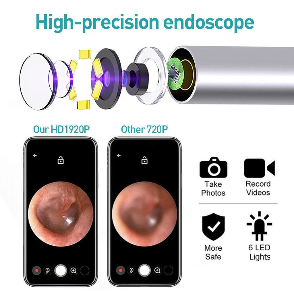 ibettertec Ohrenreiniger Ohrenreiniger Visuelle Ohrenschmalz Entferner Ohrenschmalz Entferner, Ohrenschmalz entfernen, Bilder übertragen, für iOS und Android, Ohrenschmalz-Entfernungsset Ohrreiniger mit Kamera 6 LED Leuchten