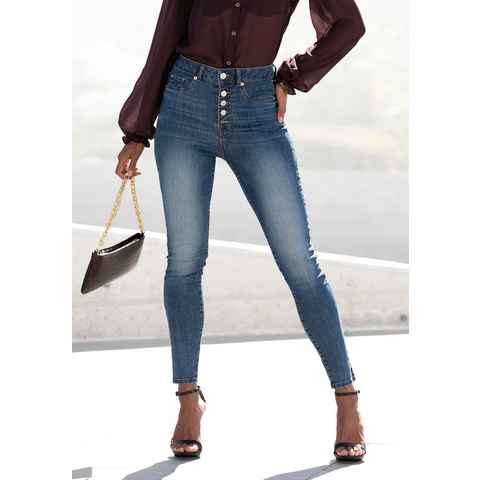 LASCANA High-waist-Jeans mit sichtbarer Knopfleiste und Stretch-Anteil