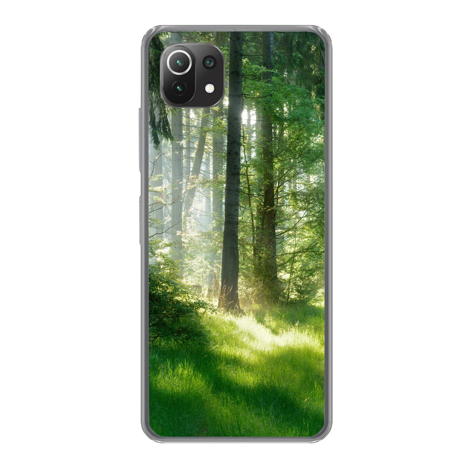 MuchoWow Handyhülle für Xiaomi Mi 11 Lite Natur - Bäume - Wald - Grün - Sonne - Gras - Pfl, Phone Case, Silikon, Schutzhülle Dünn