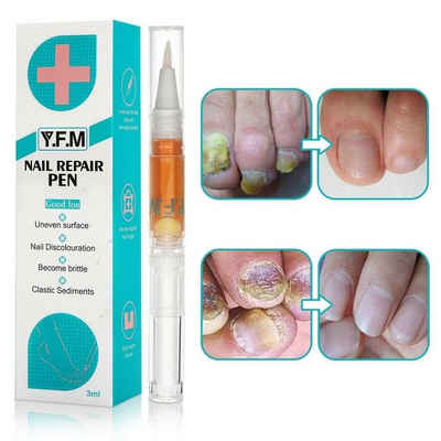 MAVURA Nagelpilz-Behandlungsstift »YFM Anti Nagelpilz Stift gegen Nagelpilz Entfernung Behandlung Fingernägel Fußnägel Pflege Nagelreparatur 3ml (1L/3300)«