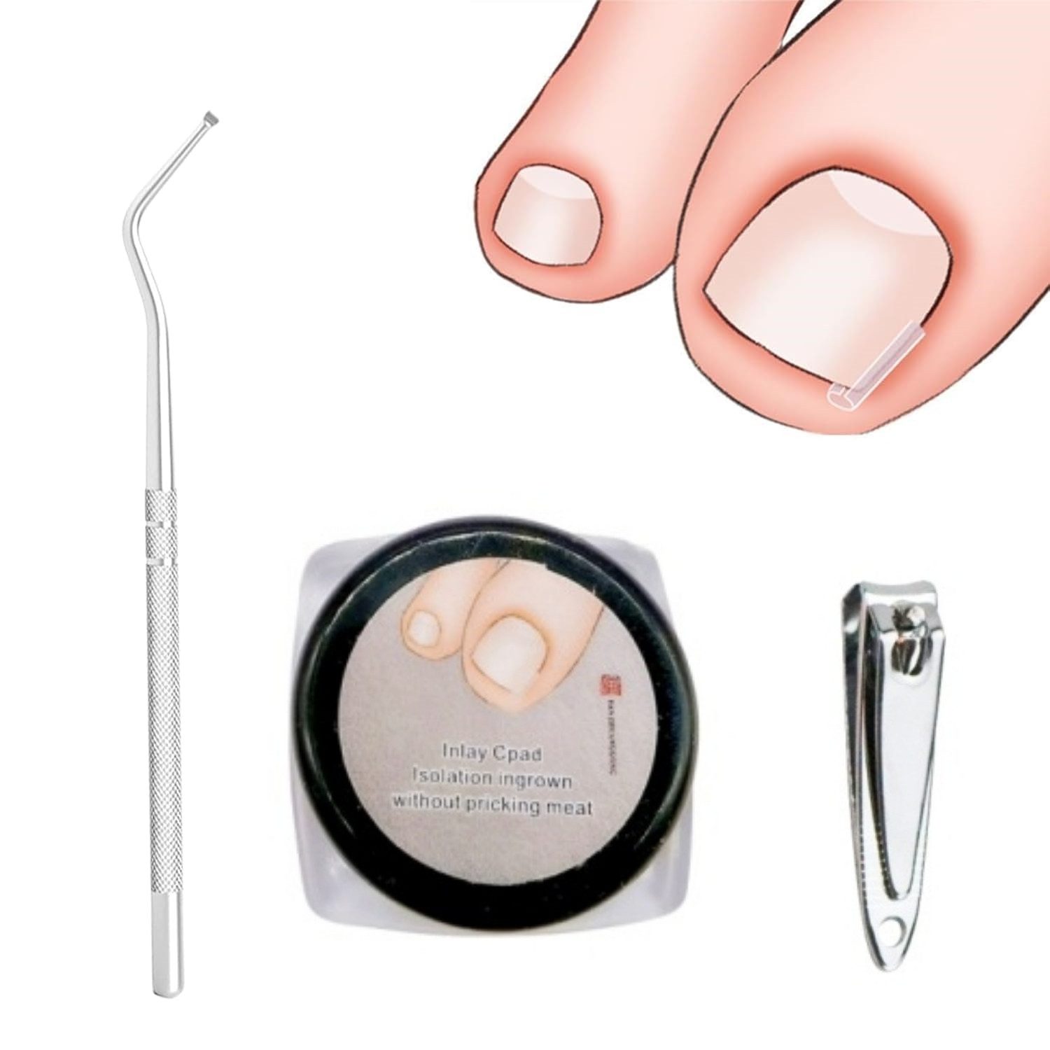 Heyork Nagelzange 50 Stück Werkzeugset für Korrekturen des Einwachsens von Zehennägeln
