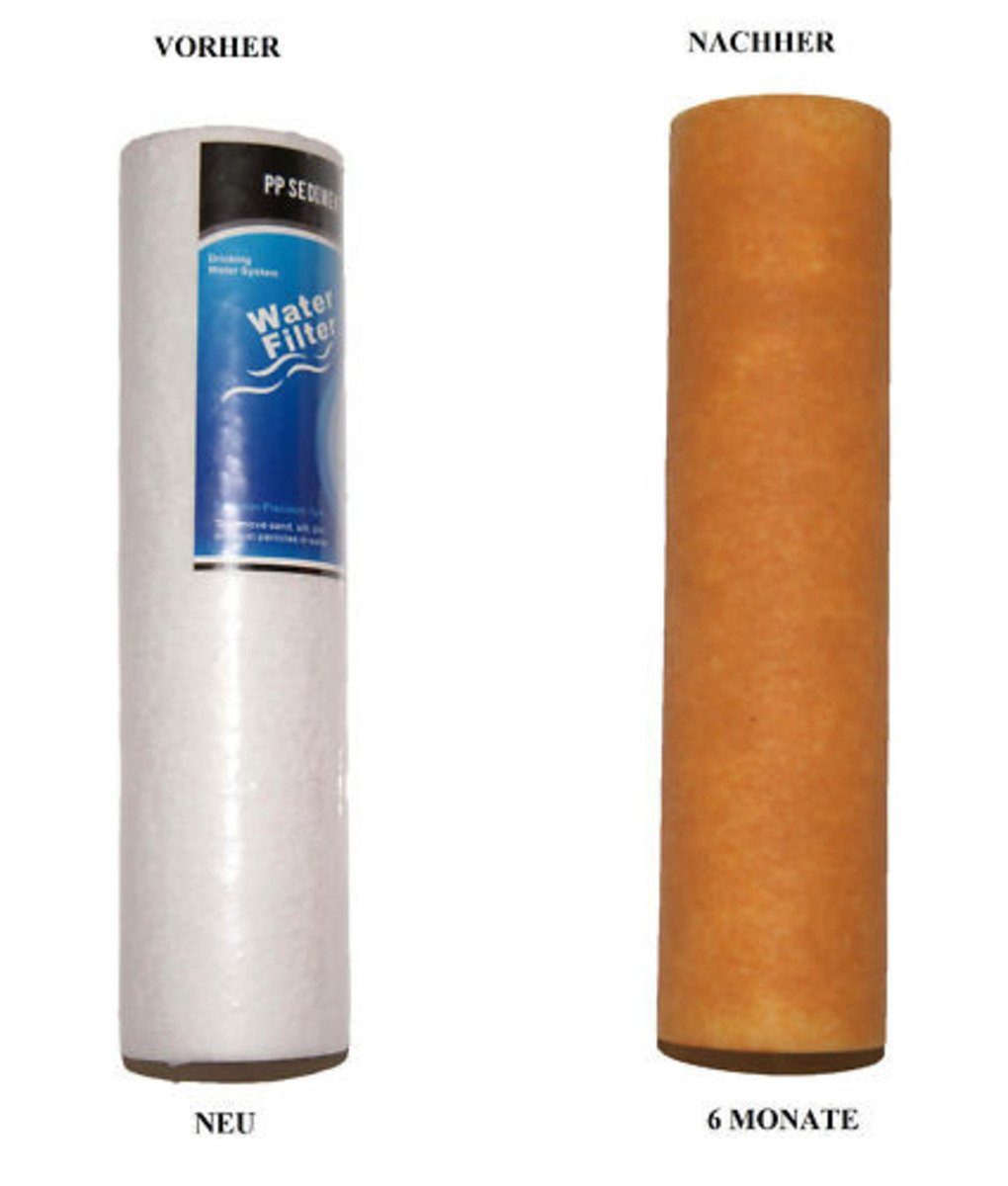 YESET Wasserfilter 5 Stufen System UMKEHROSMOSE ANLAGE WASSERFILTER Filter Drehwasserhahn