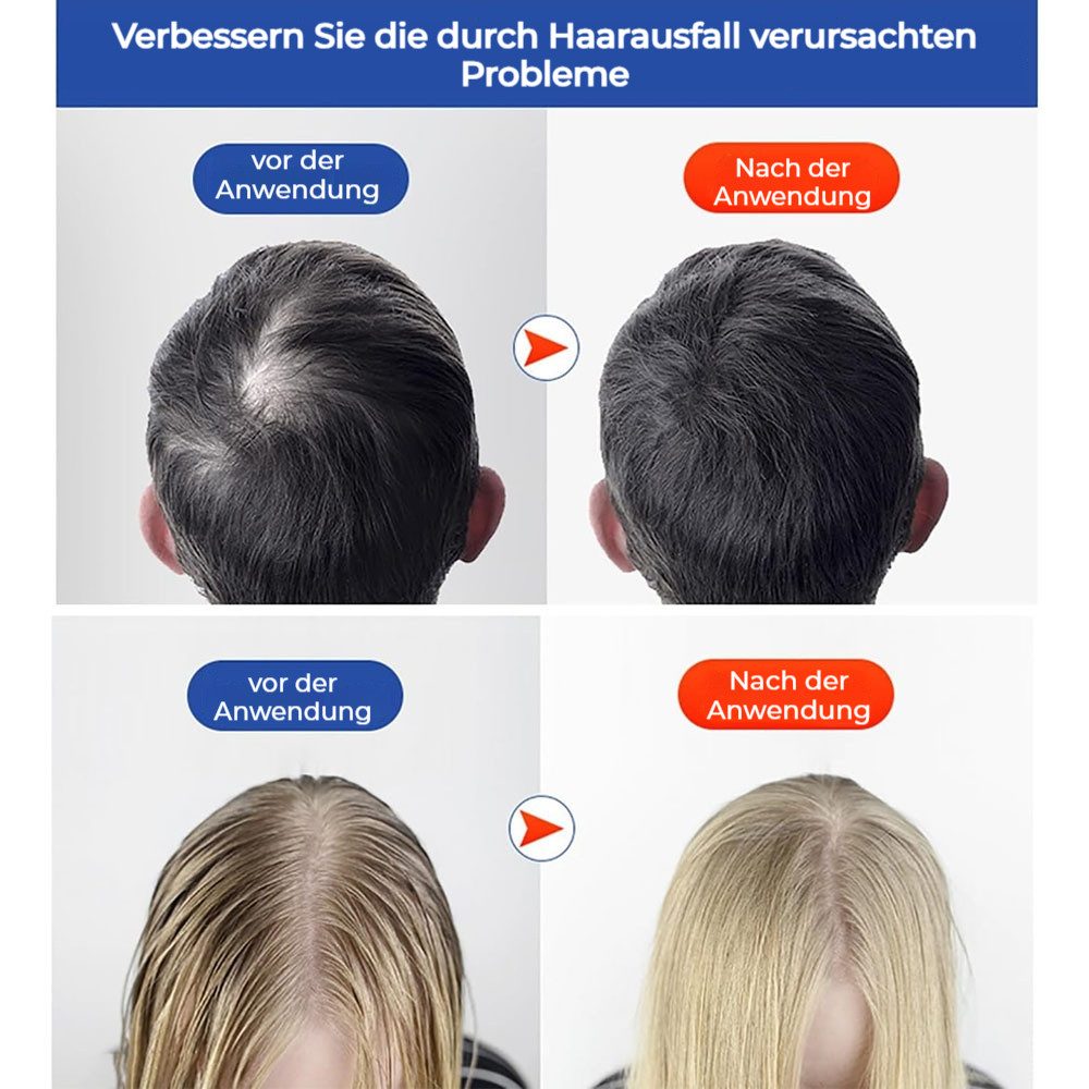 VIVIHEYDAY Infrarotlampe Rotlicht-Haarwuchshaube, 660nm/850nm LED-Therapie, für Fördert Haarwachstum & verbessert die Kopfhautgesundheit, Rotlichtfunktion