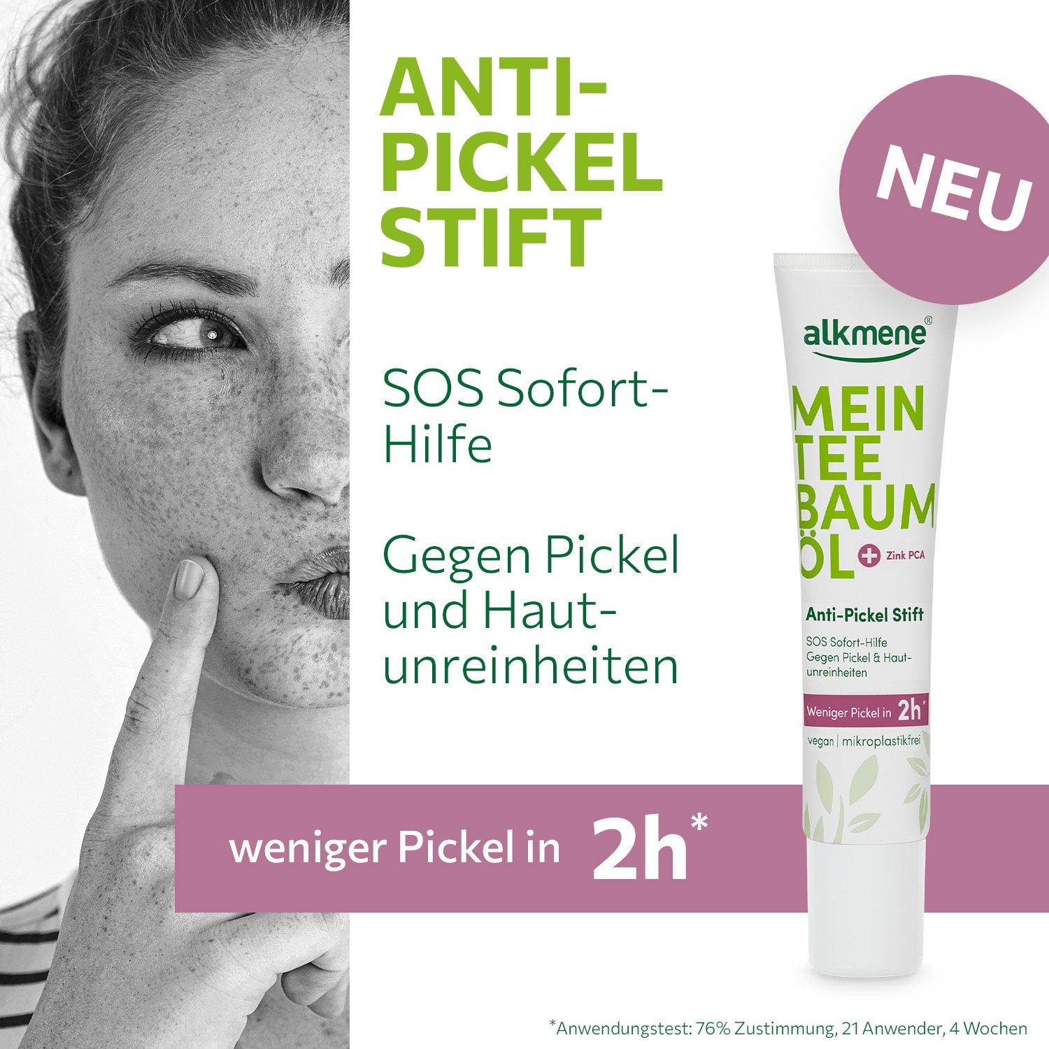 alkmene Pflegestift Teebaumöl Anti Pickel Stift weniger Pickel in 2h - Pickelstift vegan, 1-tlg.