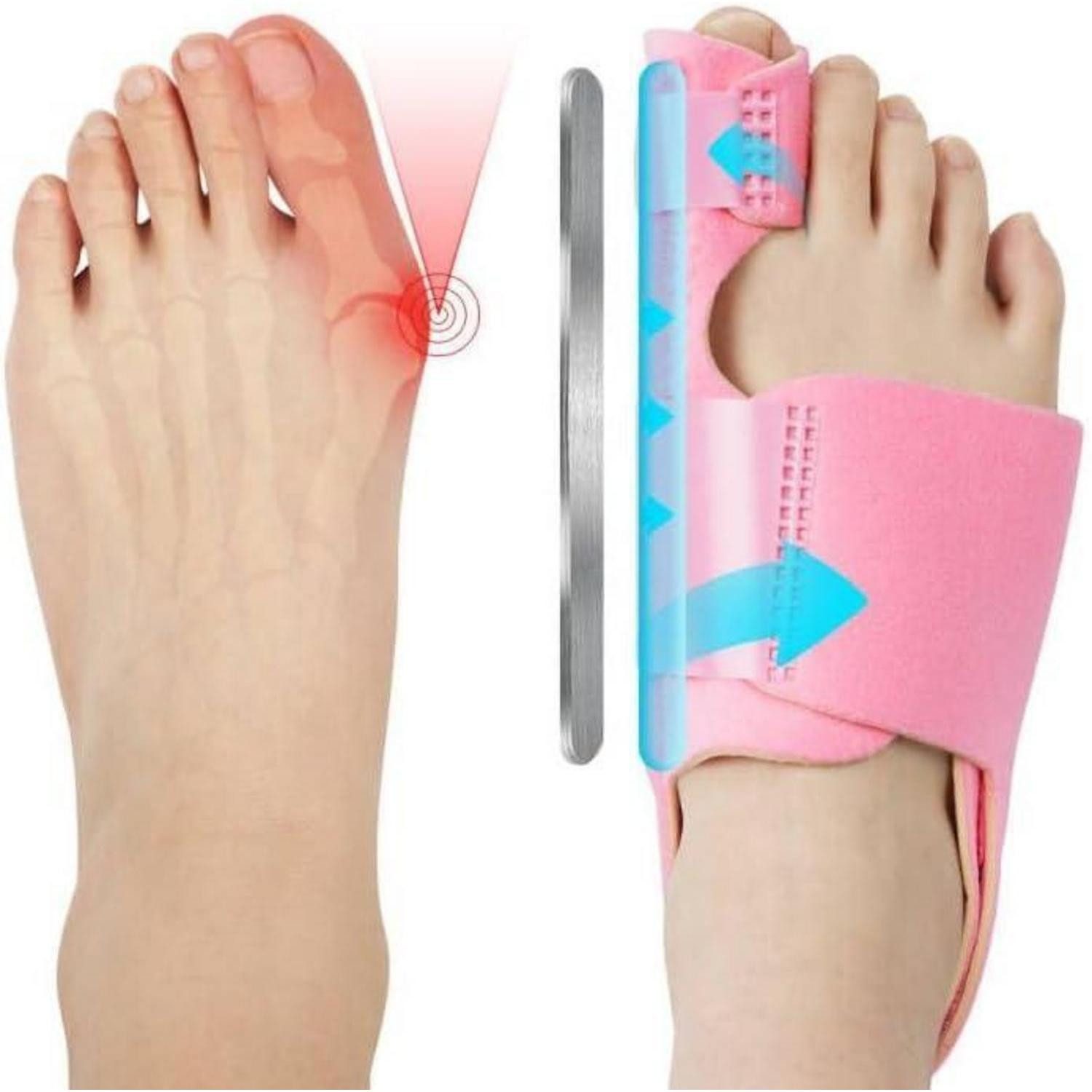LuxusKollektion Hallux-Bandage Hallux Valgus Korrektur Schiene Zehenspreizer Damen Herren Rosa