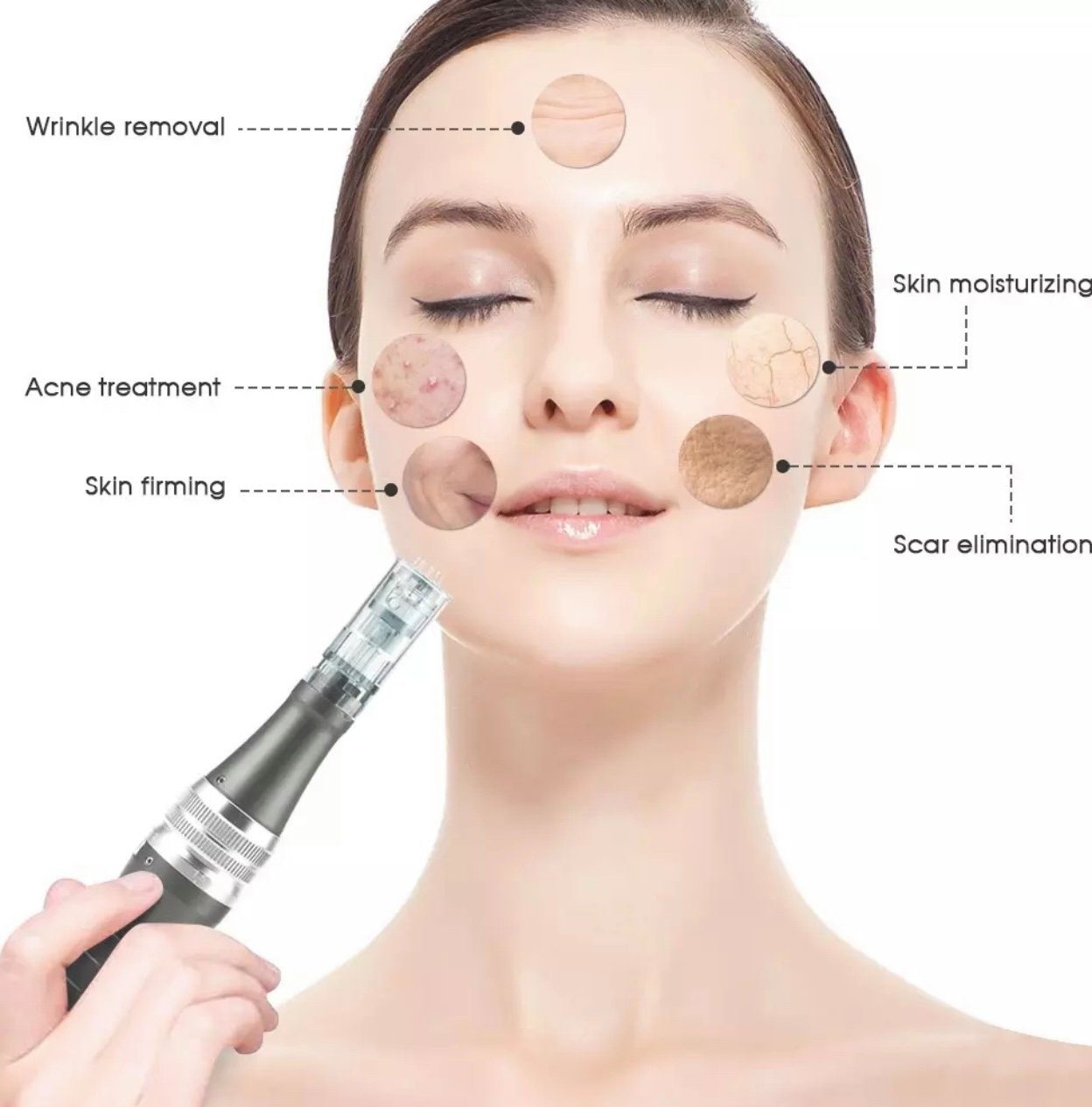 Lalano`S Cosmetics Micro-Needling Doktor needle pen, Kosmetikbehandlungsgerät, Mitesserentferner, Porenreiniger, Anti-Aging-Gerät, Akne Behandlung, Mikrodermabrasionsgerät, Derma Pen