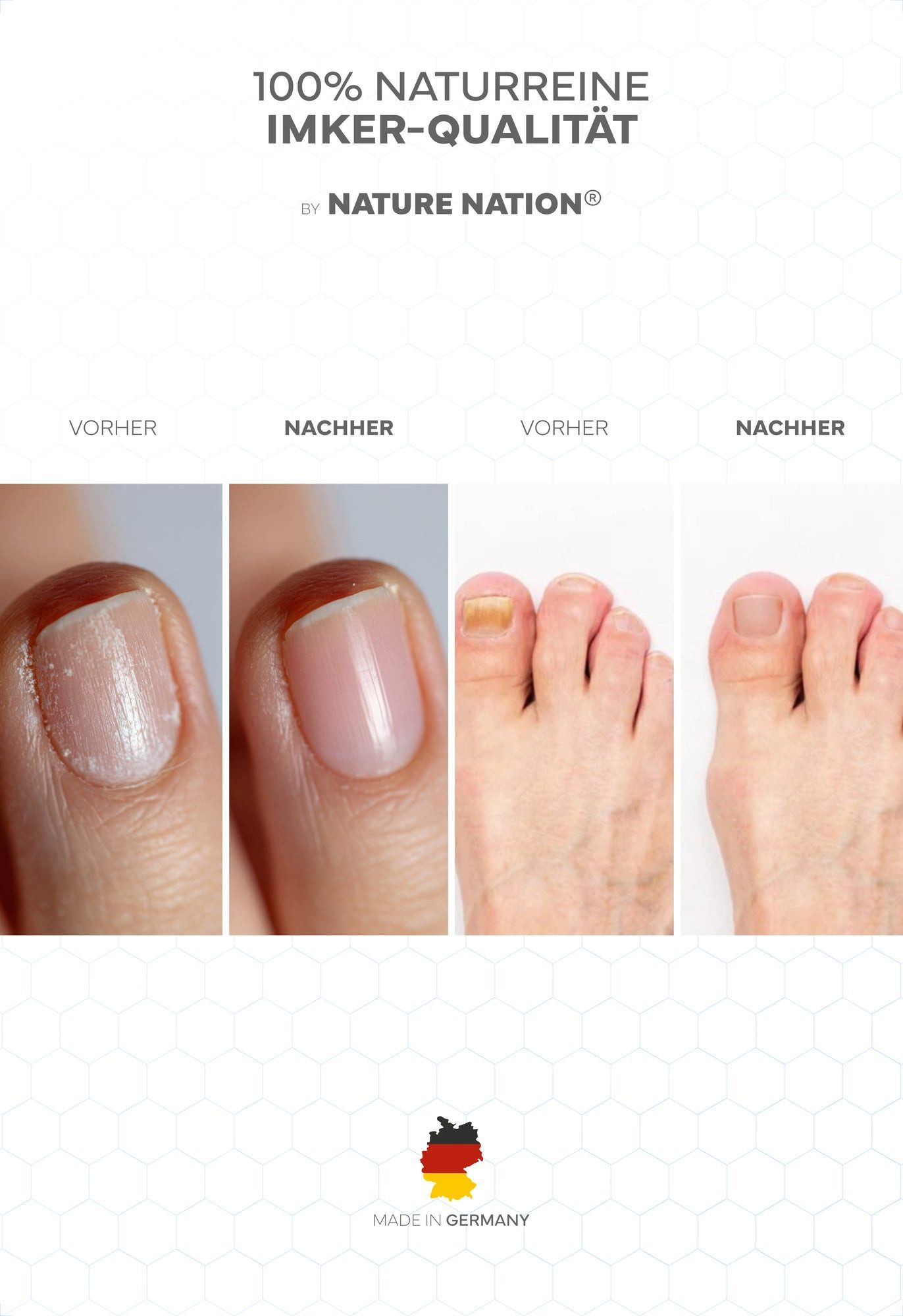NATURE NATION Körperpflegemittel BIO Propolis Nagelserum mit Teebaumöl & Lavendel Packung