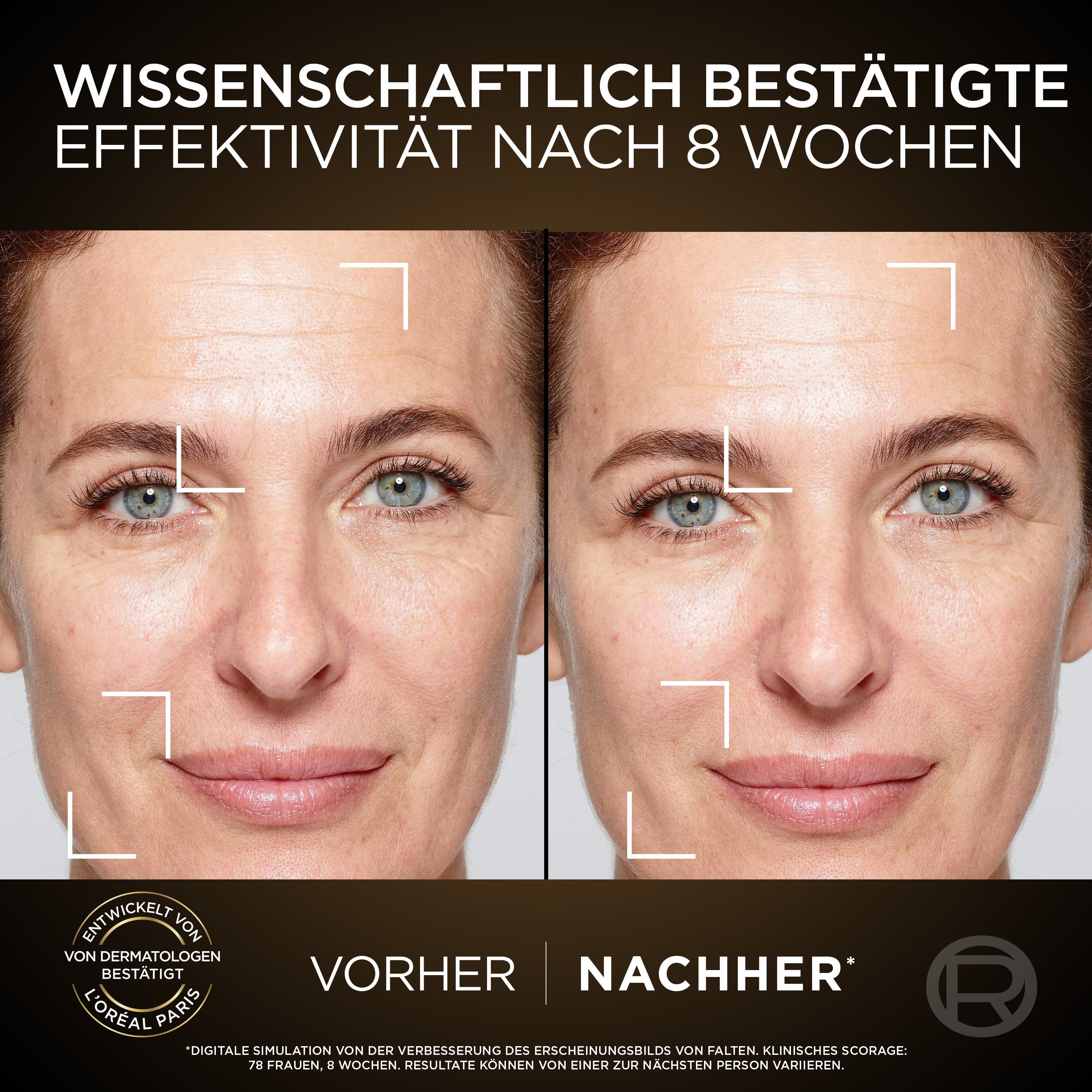 L'ORÉAL PARIS Gesichtspflege-Set L'Oréal Paris Age Perfect Zell-Renaissance Tag & Nacht Set Set, 2-tlg. – Bild 4 von 5