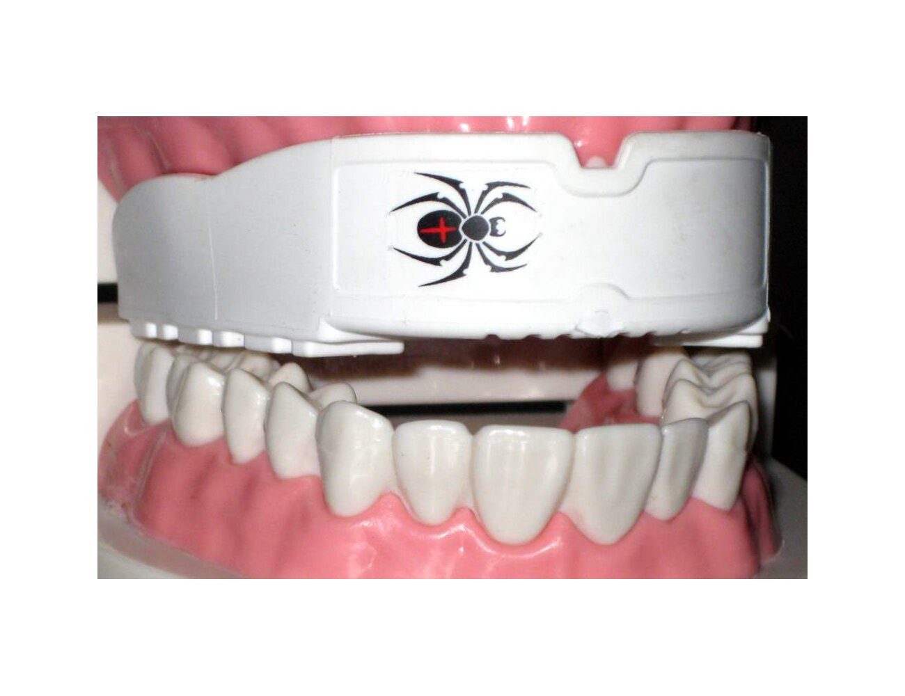 BAY-Sports Zahnschutz Zahnschützer Spinne Spider Smile Kinder Erwachsene (mit Dose, weiß, schwarz, transparent), gute Passform Zähne geschützt detaillierte Anleitung Kinder Erwachsene