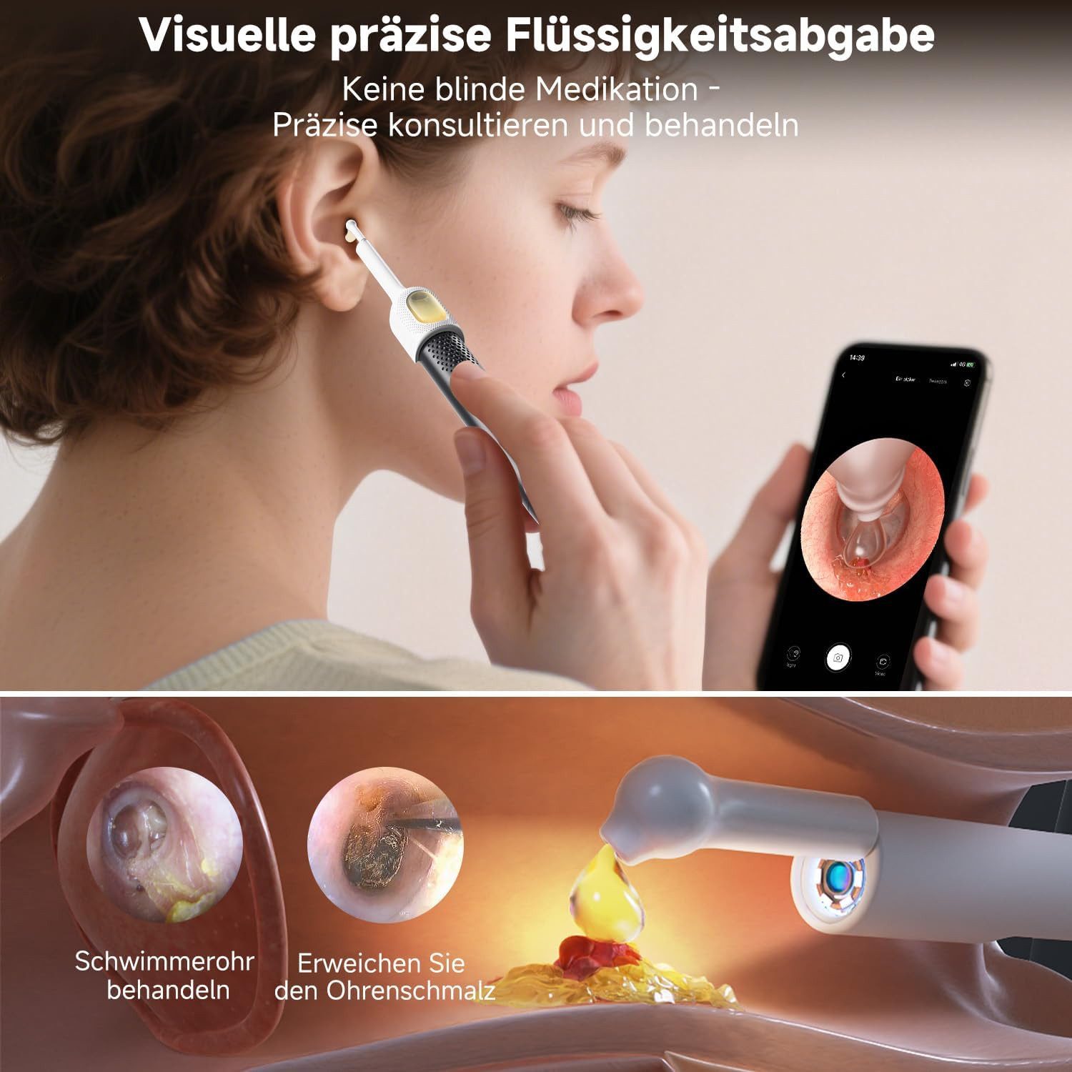 ibettertec Ohrenreiniger BEBIRD R1 Ultra Otoskop, Ohrenschmalzentferner mit Kamera, Set 1-tlg., Ohrreiniger mit Otoskop, Set mit Pinzette, Reinigungsnadeln, 1080P HDWiFimit Pinzettefür Erwachsenefür Kinderfür Baby