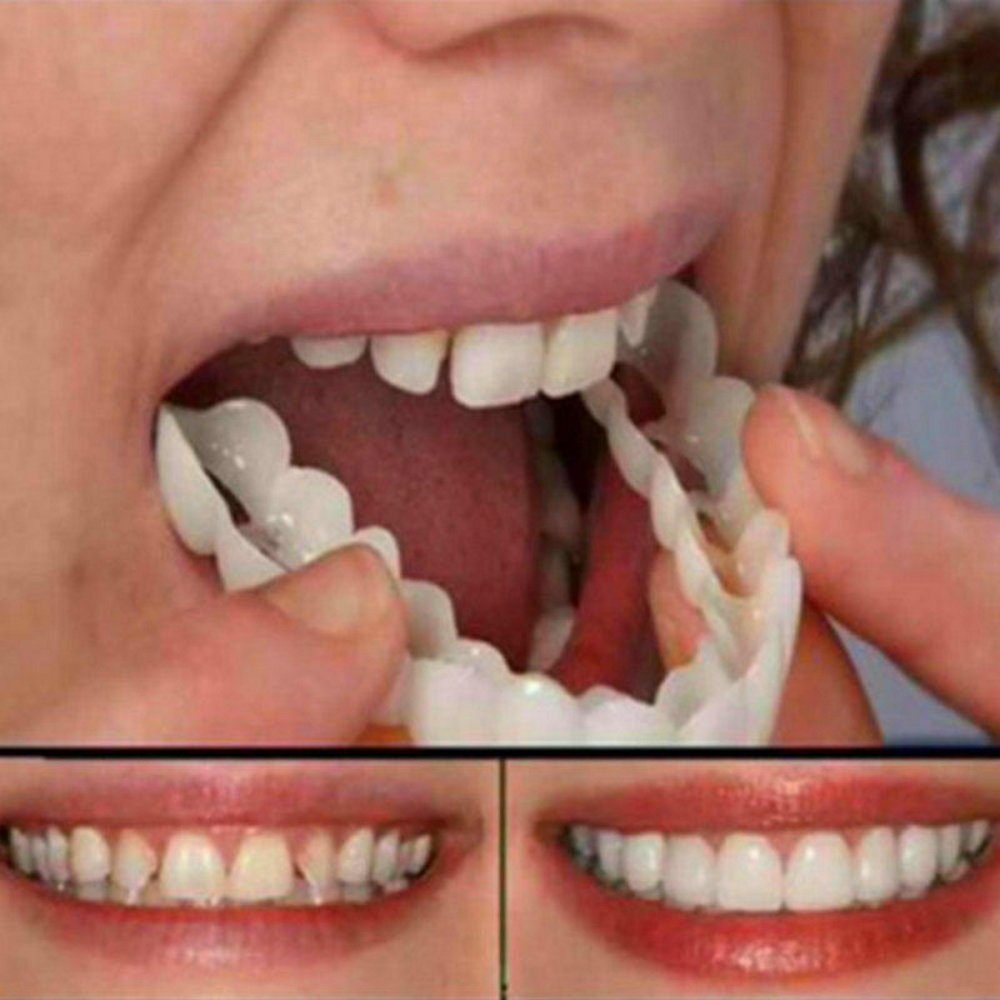 MAVURA Zahnschiene »Snap On Veneers Kosmetische Zahnblende Prothese  Zahnprothese Zahnersatz Falsche Zähne Comfort Fit Flex« online kaufen | OTTO