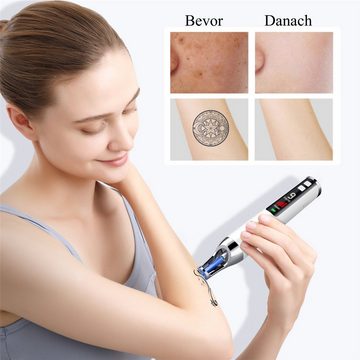 CkeyiN Kosmetikbehandlungsgerät Tattooentfernungsstift, Laser-Pikosekundenstift, Entfernung von Augenbrauenpigmenten und Akne (Blaues Licht)