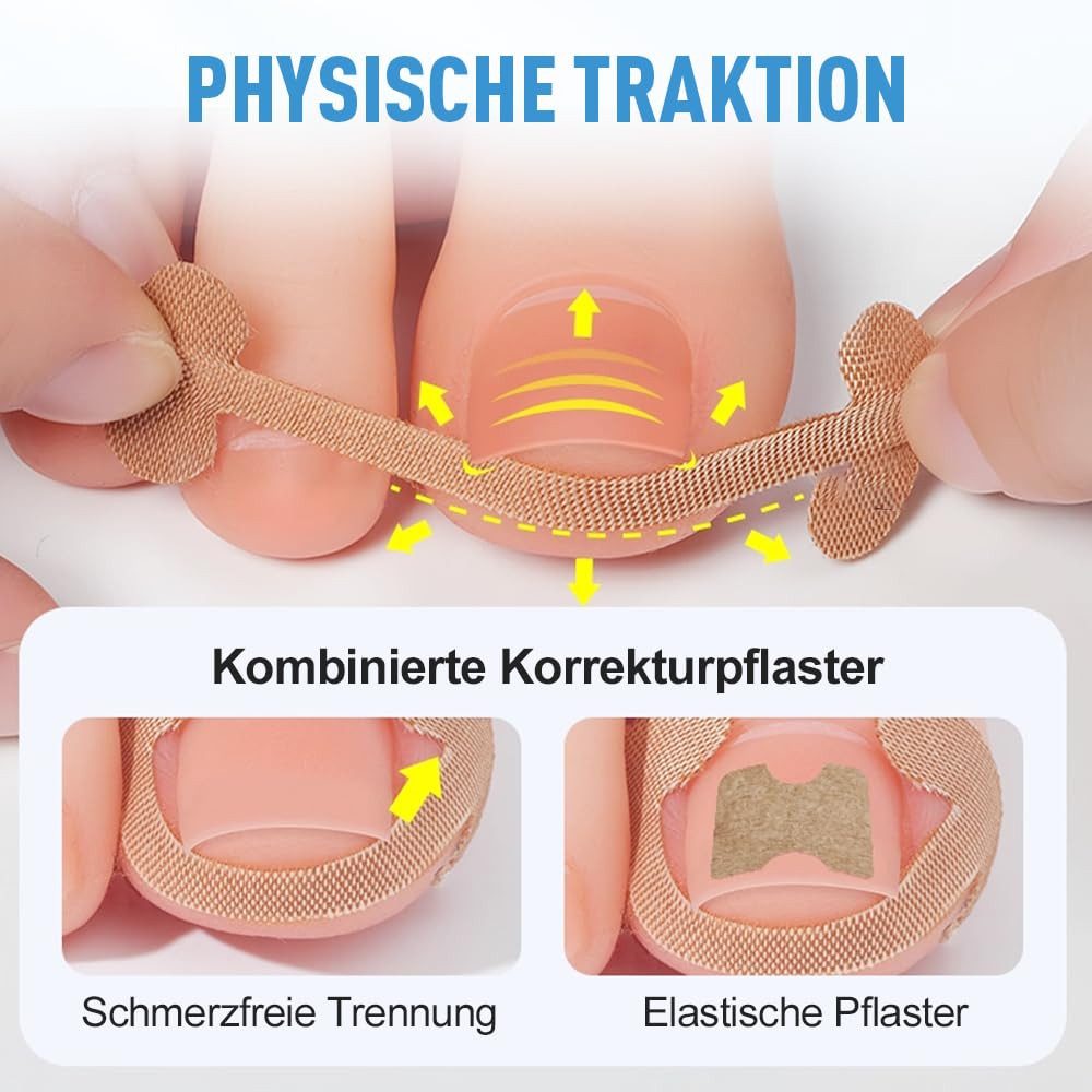 FELIXLEO Nagelzange Eingewachsener Zehennagel Set 16tlg Pediküre Nagelzange, 1-tlg.