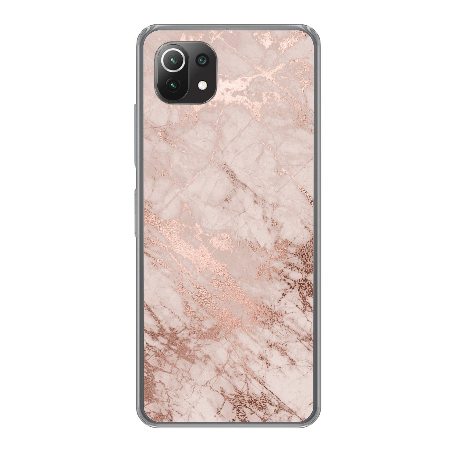 MuchoWow Handyhülle für Xiaomi Mi 11 Lite Marmor - Rosa - Luxus - Marmoroptik - Glitzer -, Phone Case, Silikon, Schutzhülle Dünn