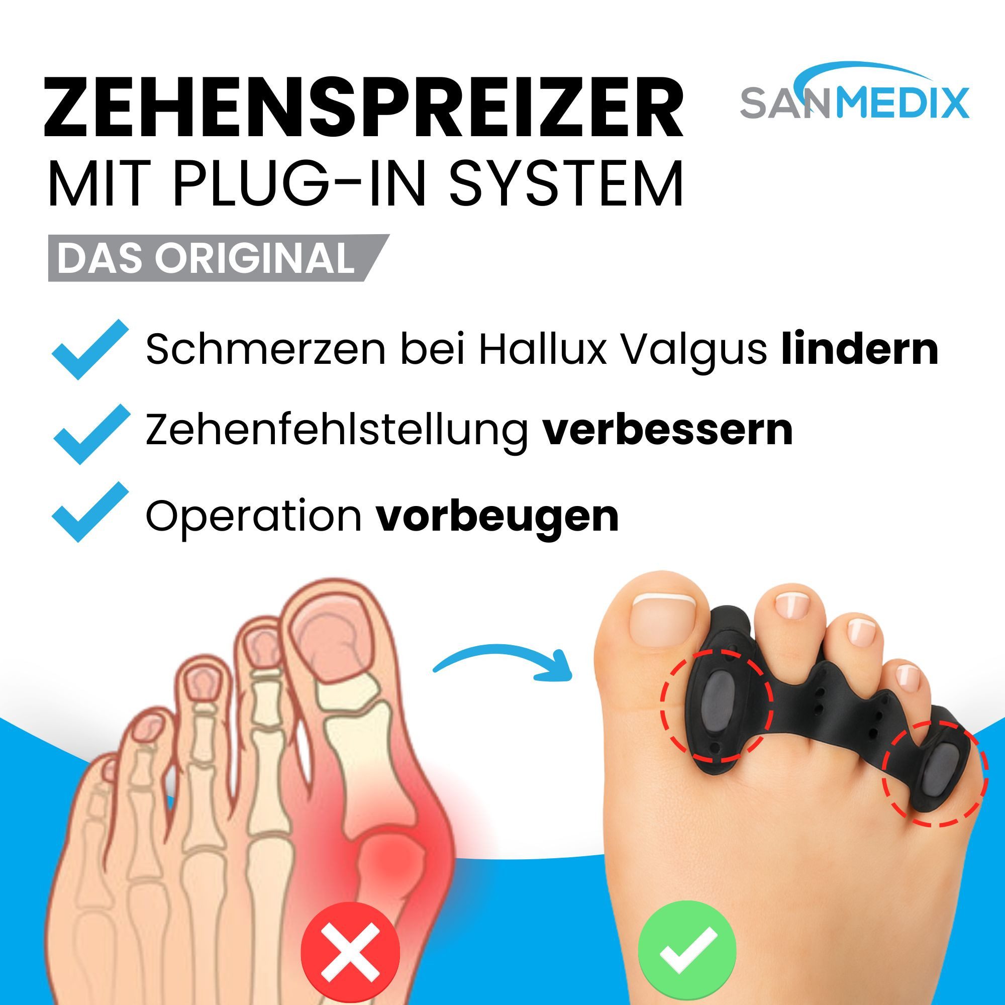 Sanmedix Zehenspreizer für alle Zehen - mit Plug-In System aus Silikon für Damen & Herren, 2 Paar (4 Stück + 4 Plug-Ins), Zehenstrecker Korrektur Set gegen Hallux Valgus, Ballenzehen uvm.