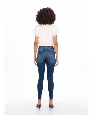 ONLY 5-Pocket-Jeans Damen Jeans ONLBLUSH MID ANKLE Skinny Fit (1-tlg)