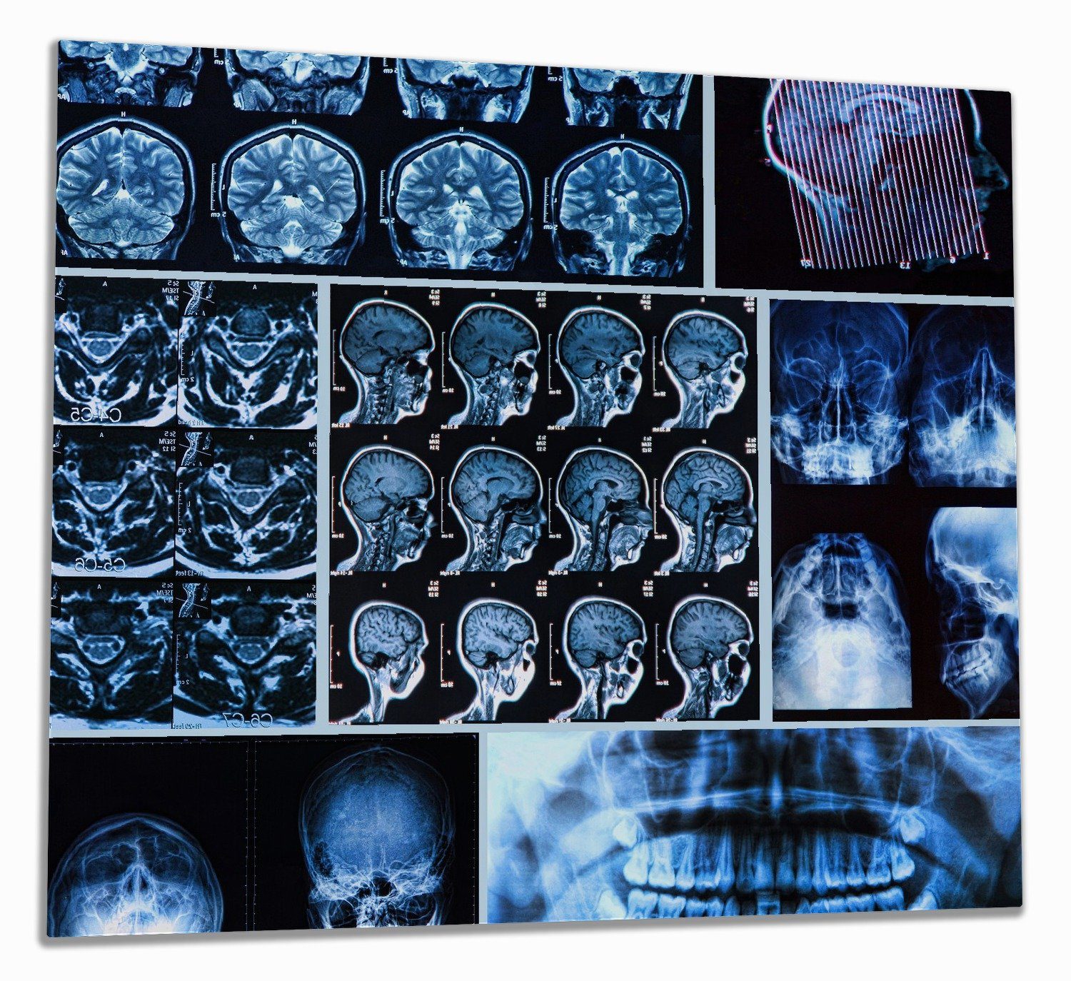 Wallario Herd-Abdeckplatte Röntgen-Bilder eines menschlichen Kopfes von allen Seiten, ESG-Sicherheitsglas, (Glasplatte, 1 tlg., inkl. 5mm Noppen), verschiedene Größen