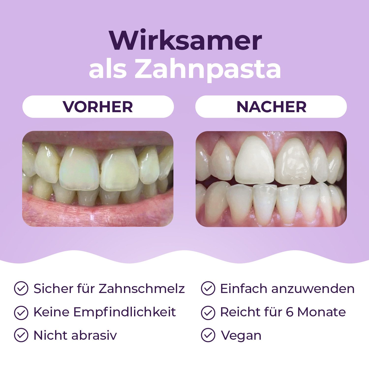 OnlySmile Zahnbleaching-Pulver Zahnaufhellung Pulver - Testsieger - Teeth Whitening Powder, Zahnaufhellung, Bleaching Powder, Aufhellen, weiße Zähne