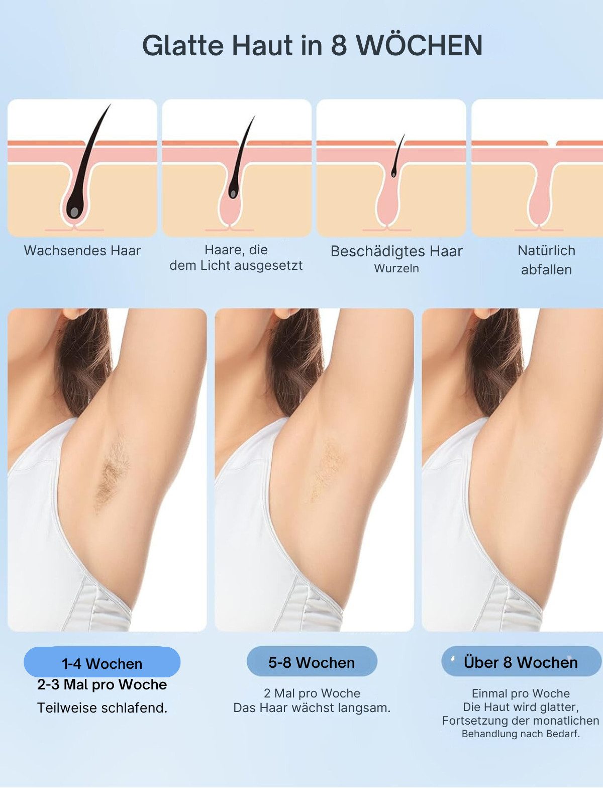 Vivitar IPL-Haarentferner Pulslicht Epilierer Laser Epilierer für Frauen und Männer, schmerzfreie dauerhafte Haarentfernung, für Gesicht, Arme, Beine, Achseln, Bikini, 6 Leistungsstufen